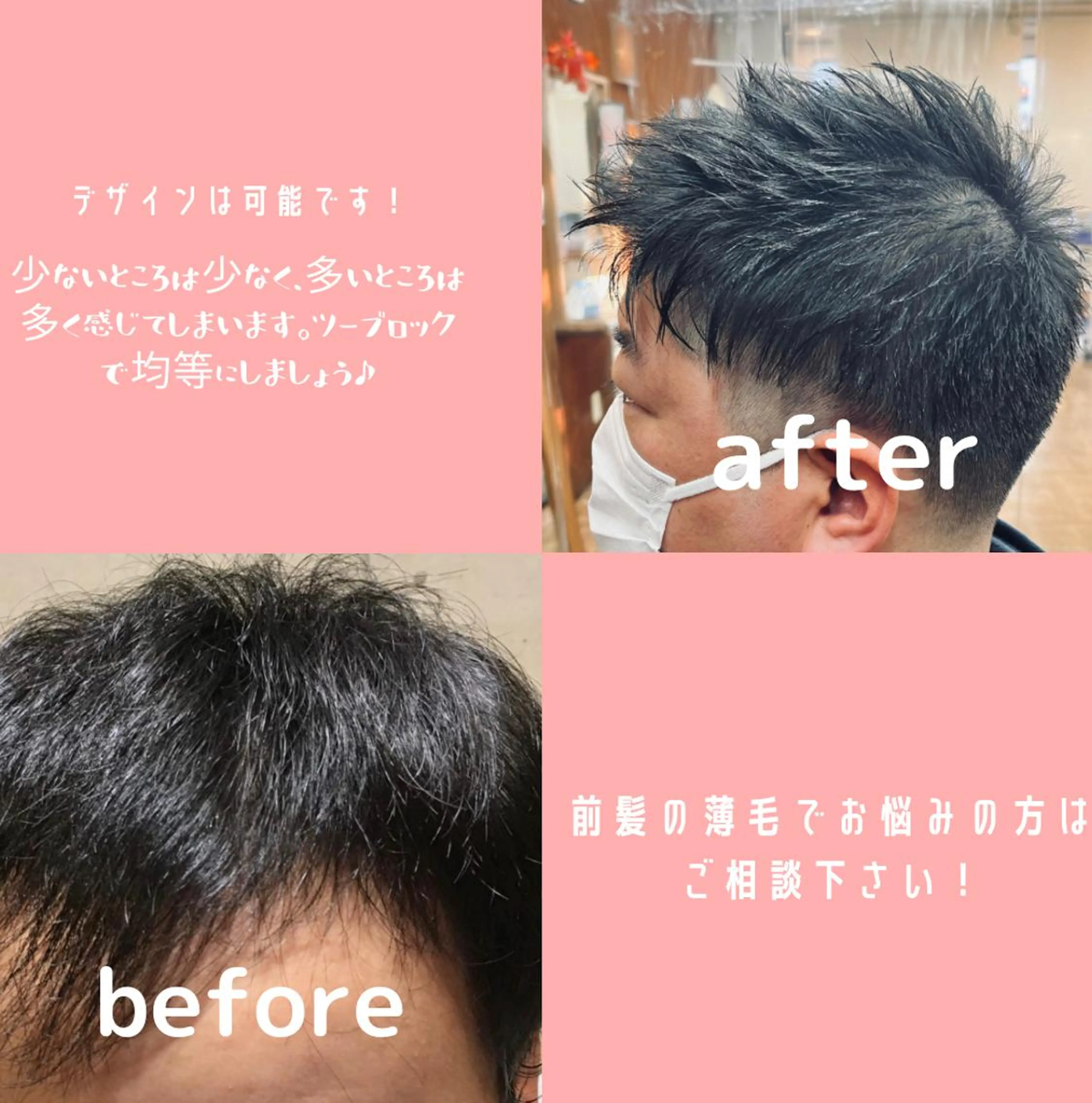 ショート メンズ 薄毛専門 メンズカットREEのヘアスタイル