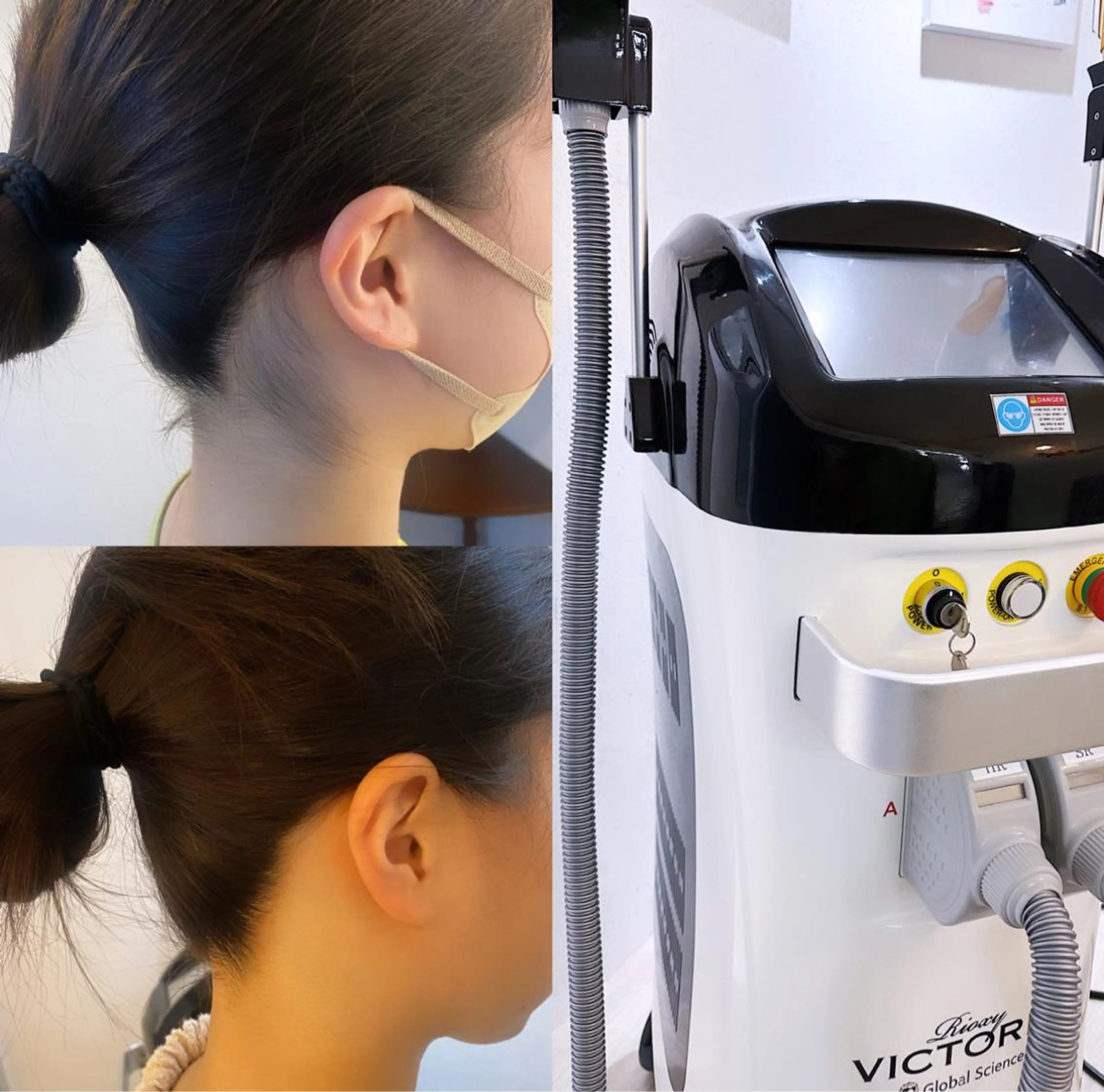 脱毛 うなじ脱毛/美肌脱毛 LABELのエステ・リラクイメージ