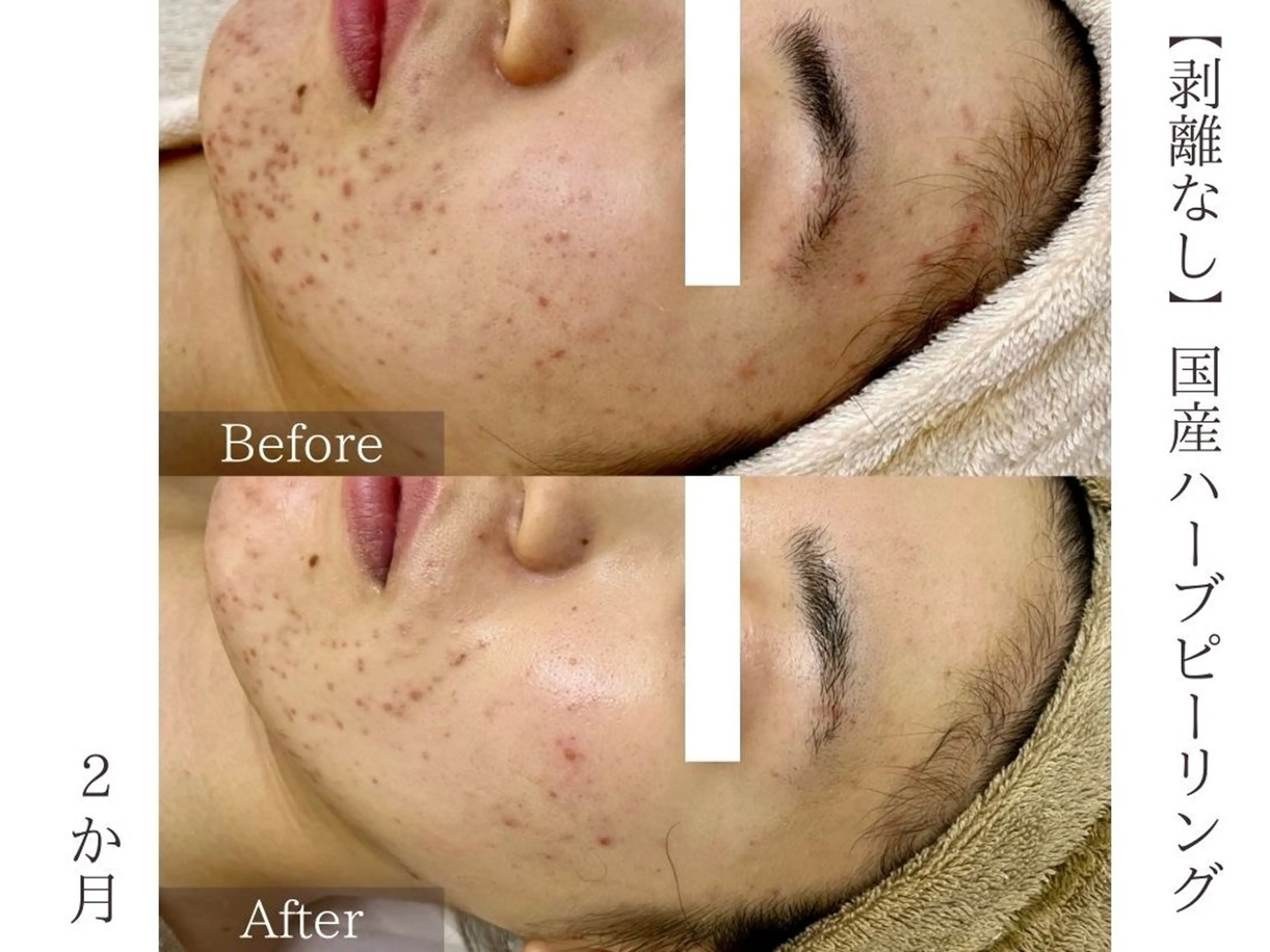 肌質改善サロン renew/ｳｴｷのエステ・リラクイメージ