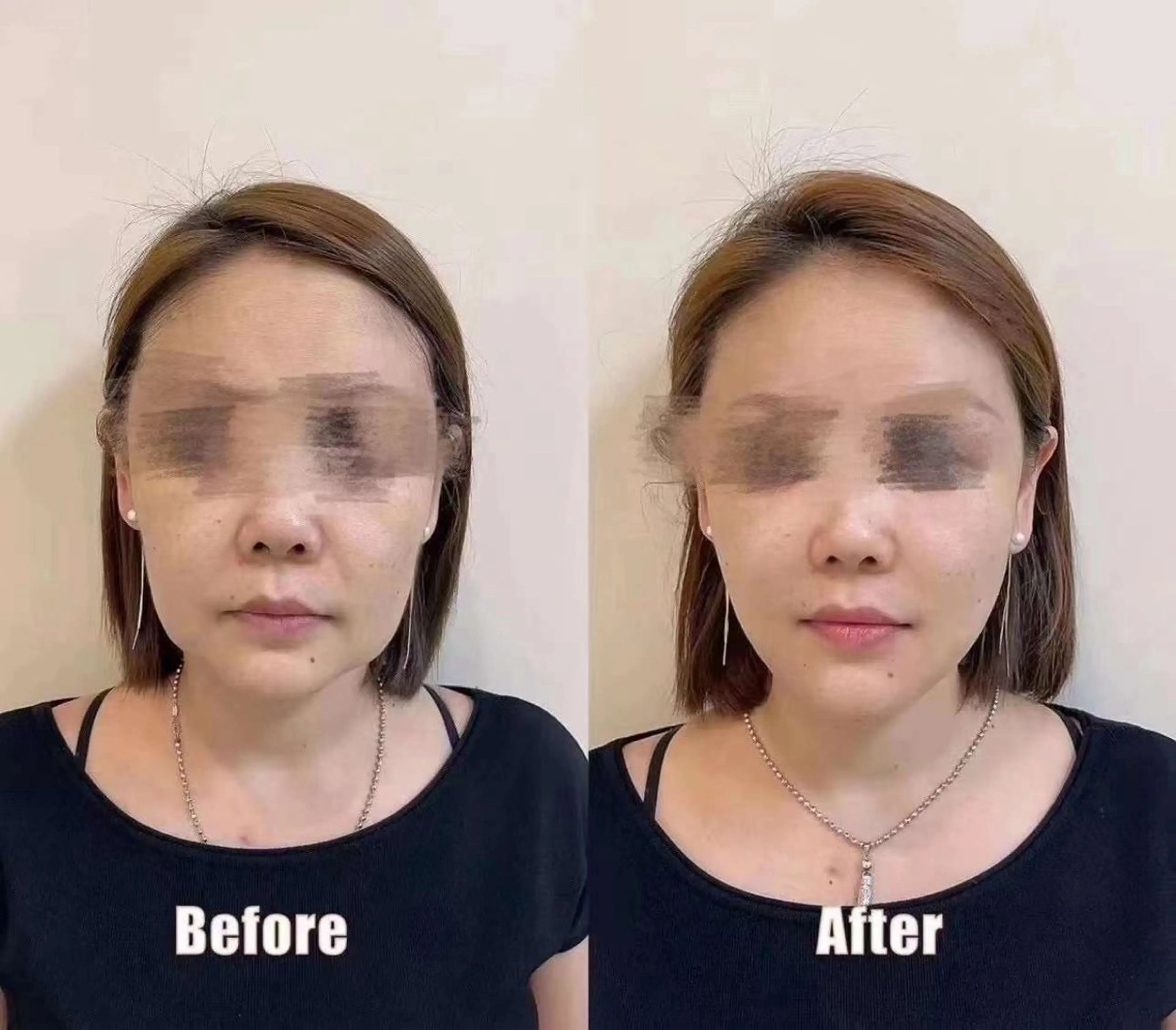 マツエク・マツパ 韓国風マツエク エステ aliaハーブ水光店 エステティシャン募集のエステ・リラクイメージ