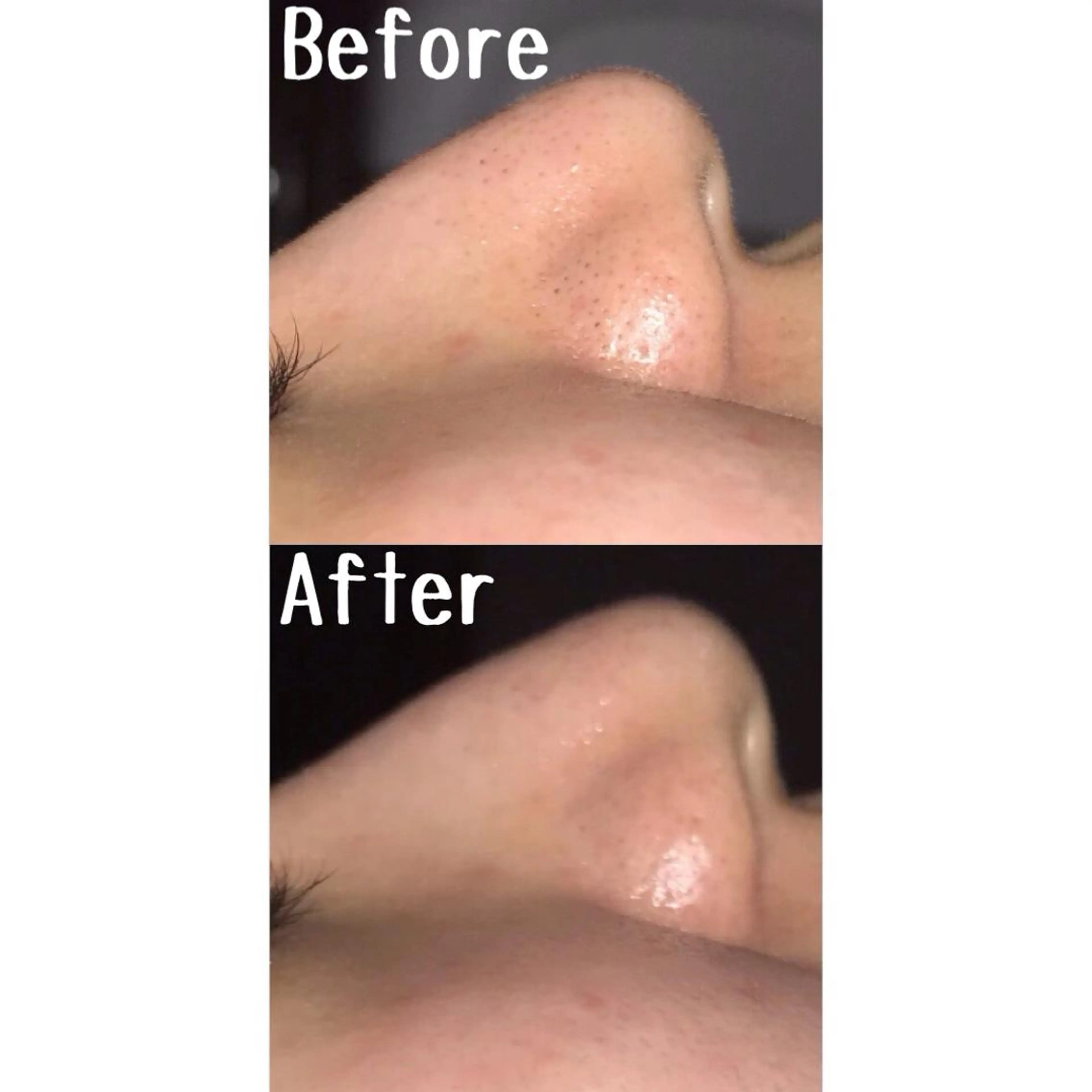 エステ ゆか/エステサロン Lilasmileのエステ・リラクイメージ