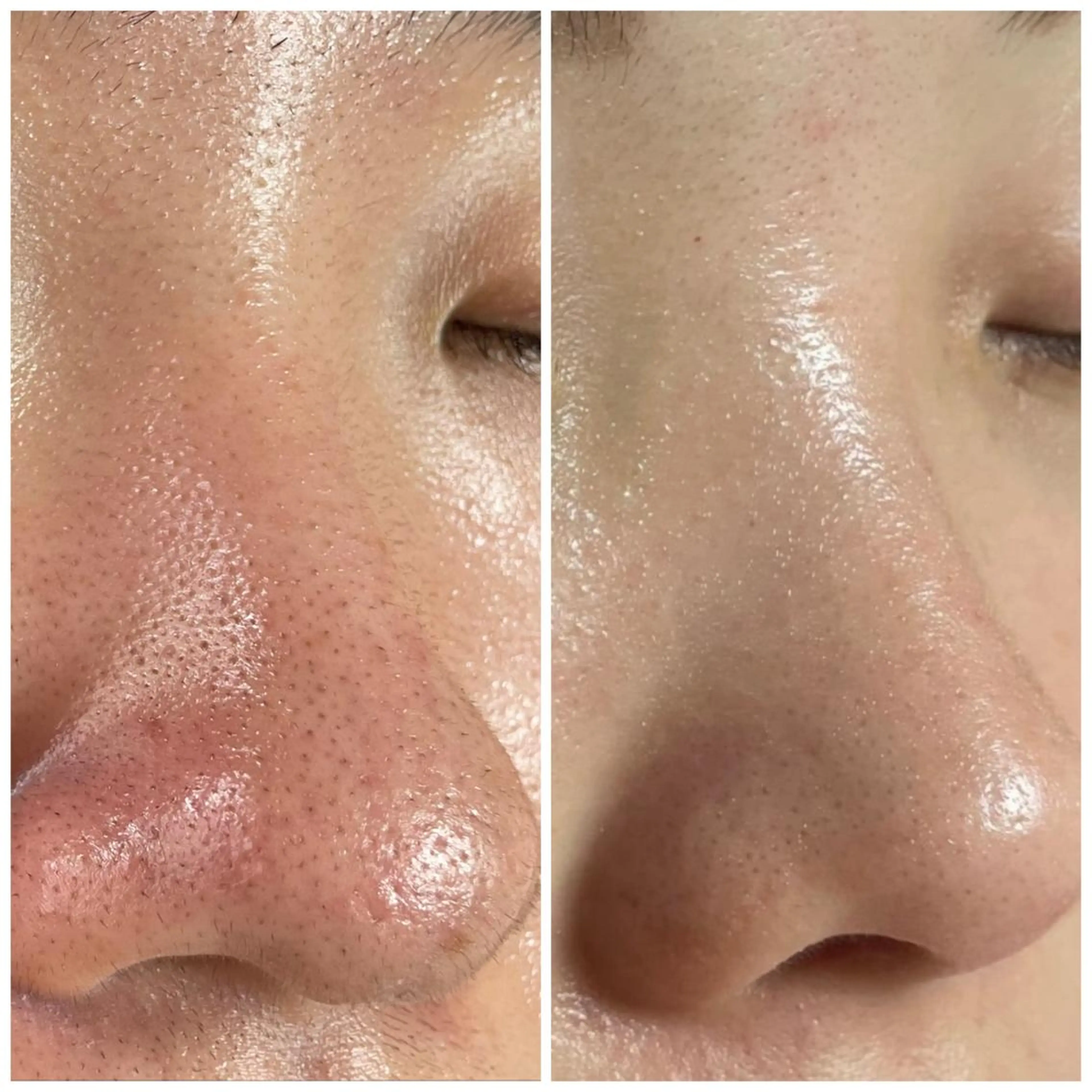 エステ リラク Linomalie エステ/たるみ/脱毛のエステ・リラクイメージ