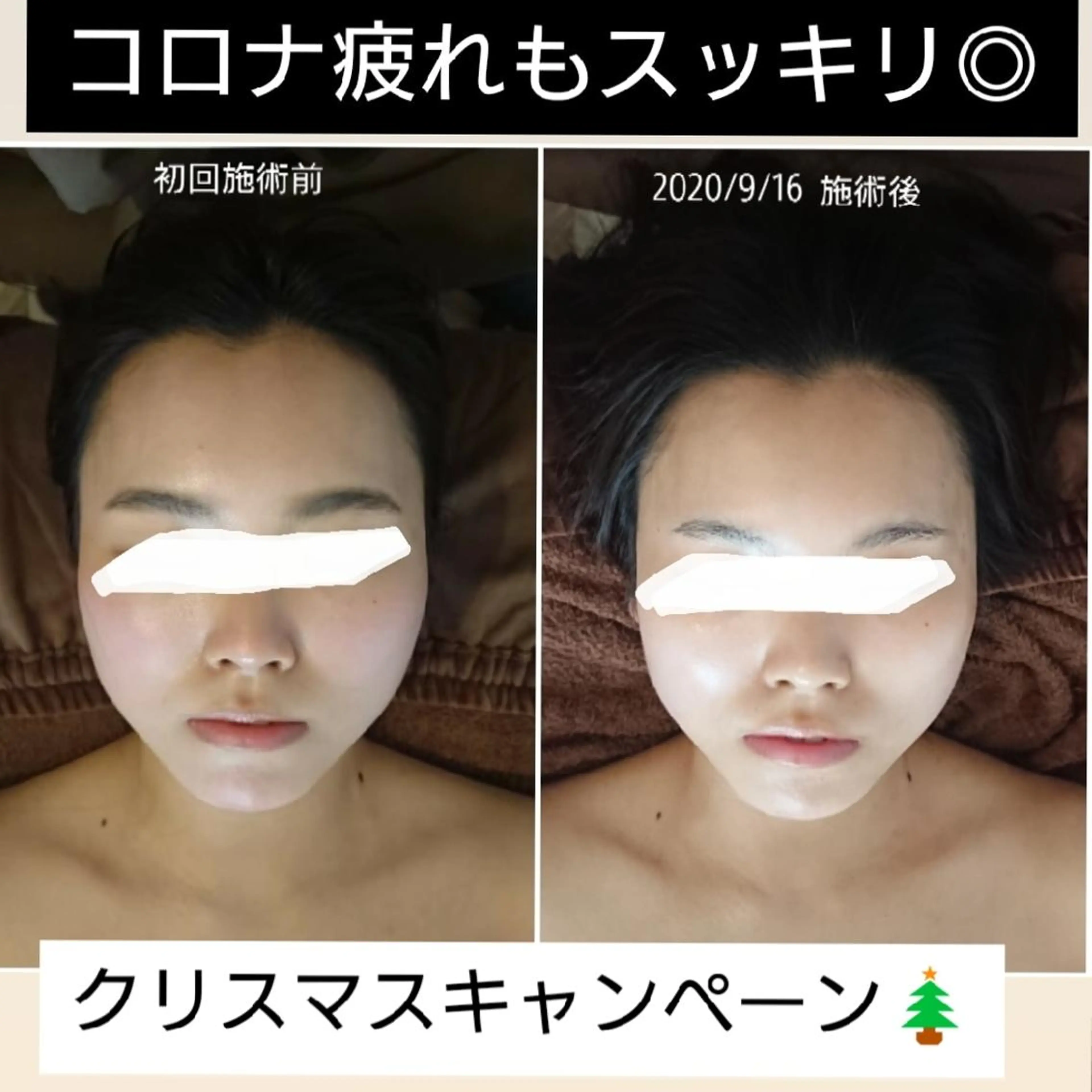 小顔美容整体& 美爪育成Jelissのエステ・リラクイメージ