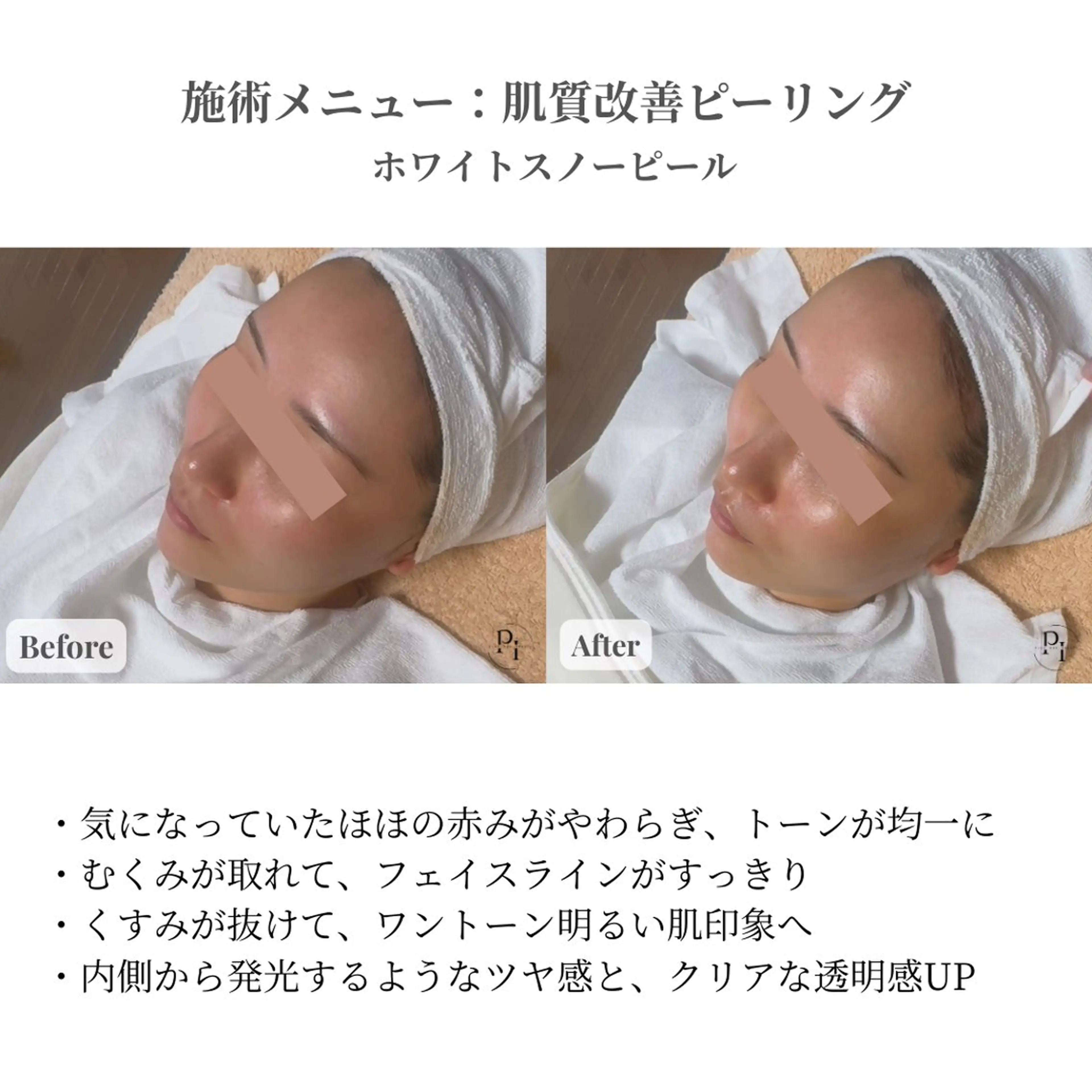 【新大阪】痩身/小顔 美肌フェイシャルのエステ・リラクイメージ