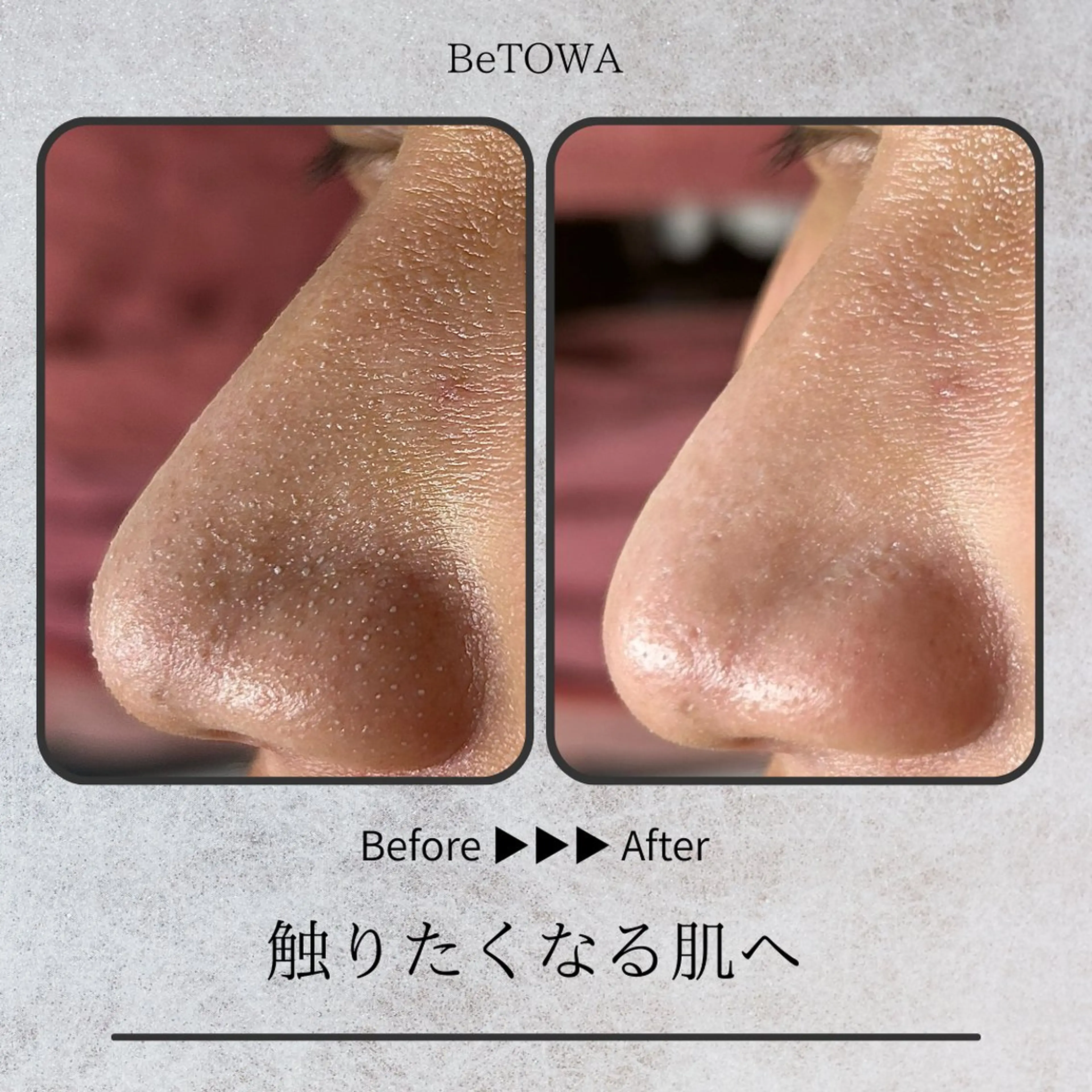 エステ BeTOWA所属・BeTOWA 毛穴洗浄／Wax脱毛のエステ・リラクイメージ