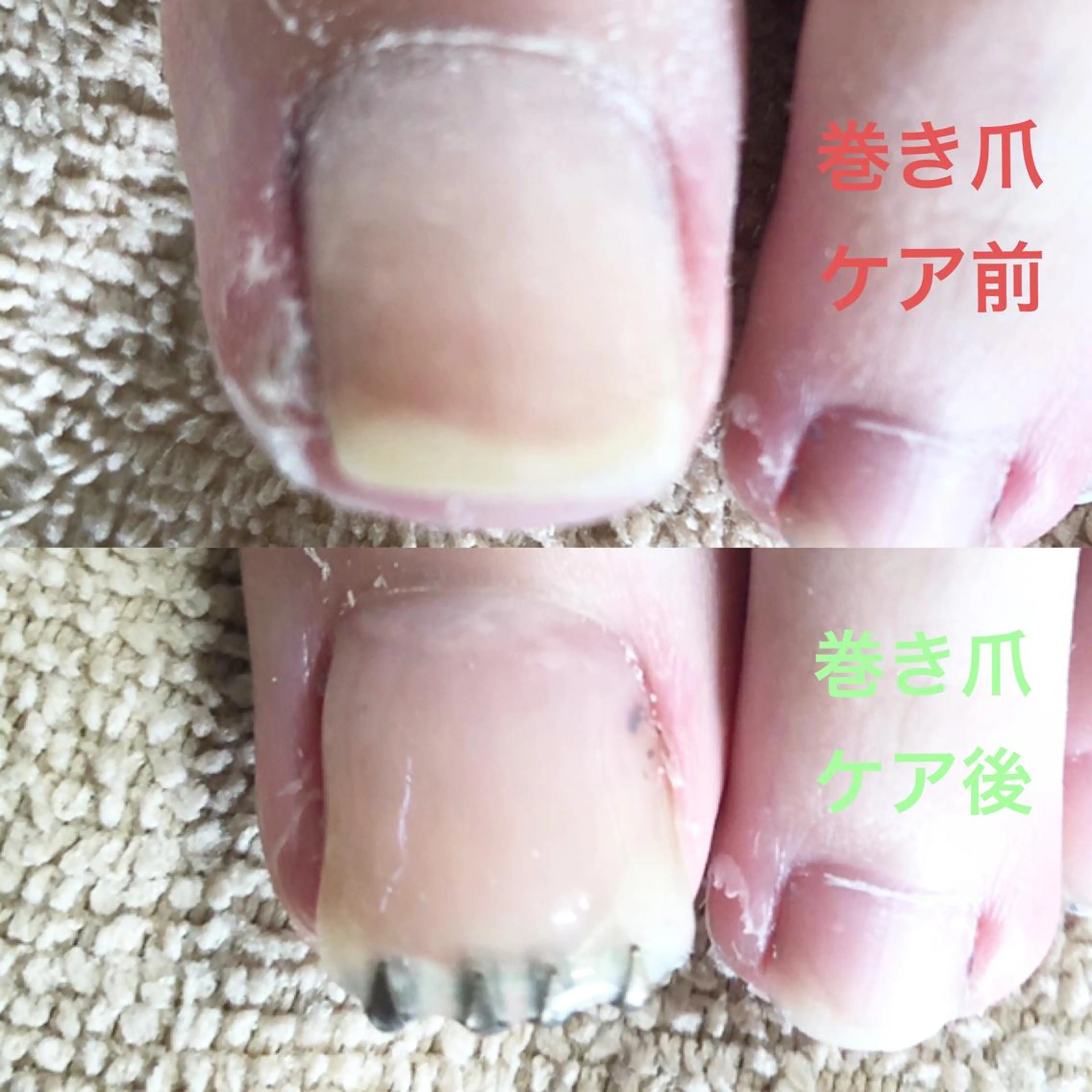 メンズ キッズ ネイル クリアネイル ジェルネイル 🌱 ま し お 🌱のその他イメージ