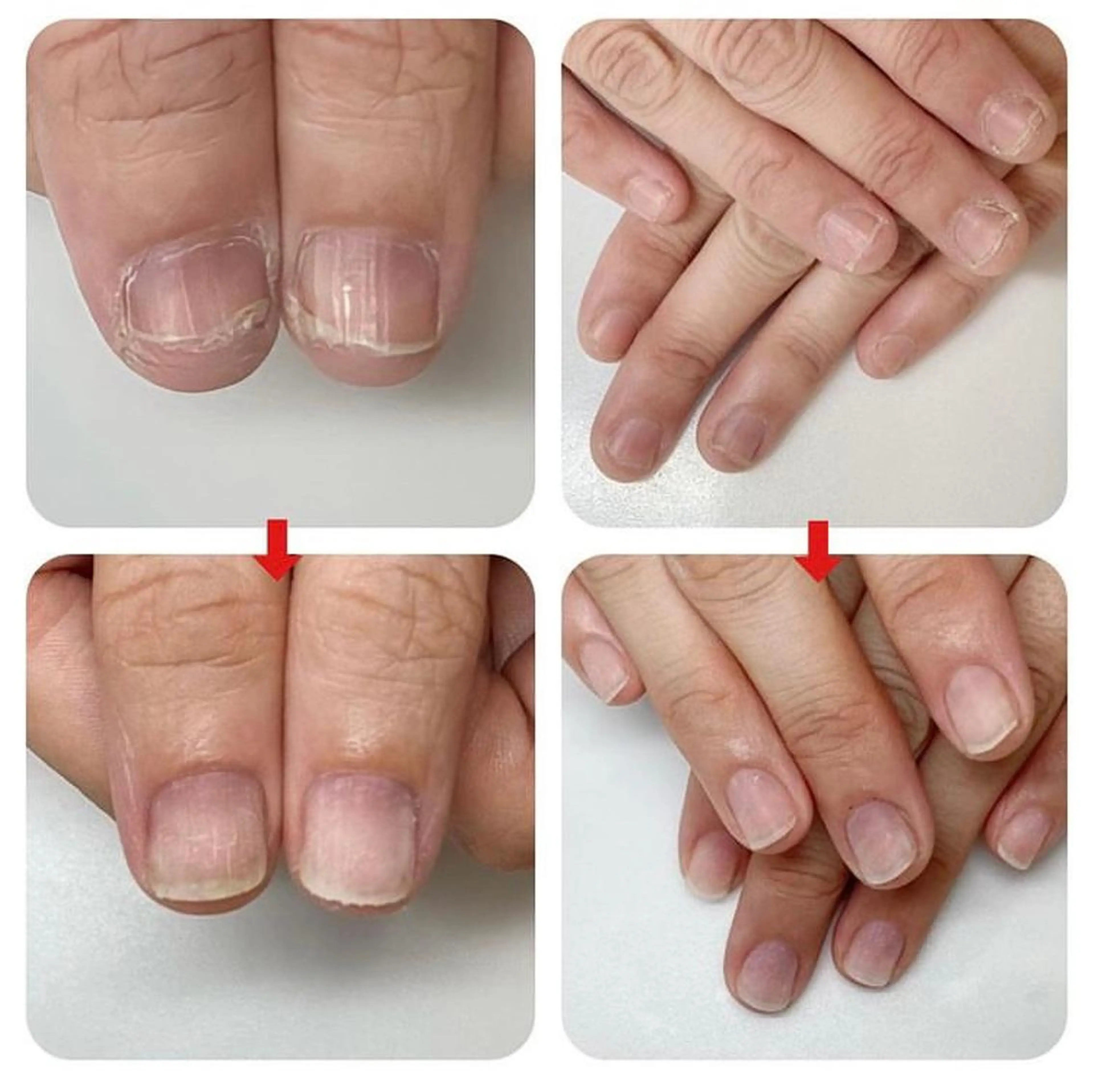 ネイル ネイルサロン アリュームのネイルデザイン