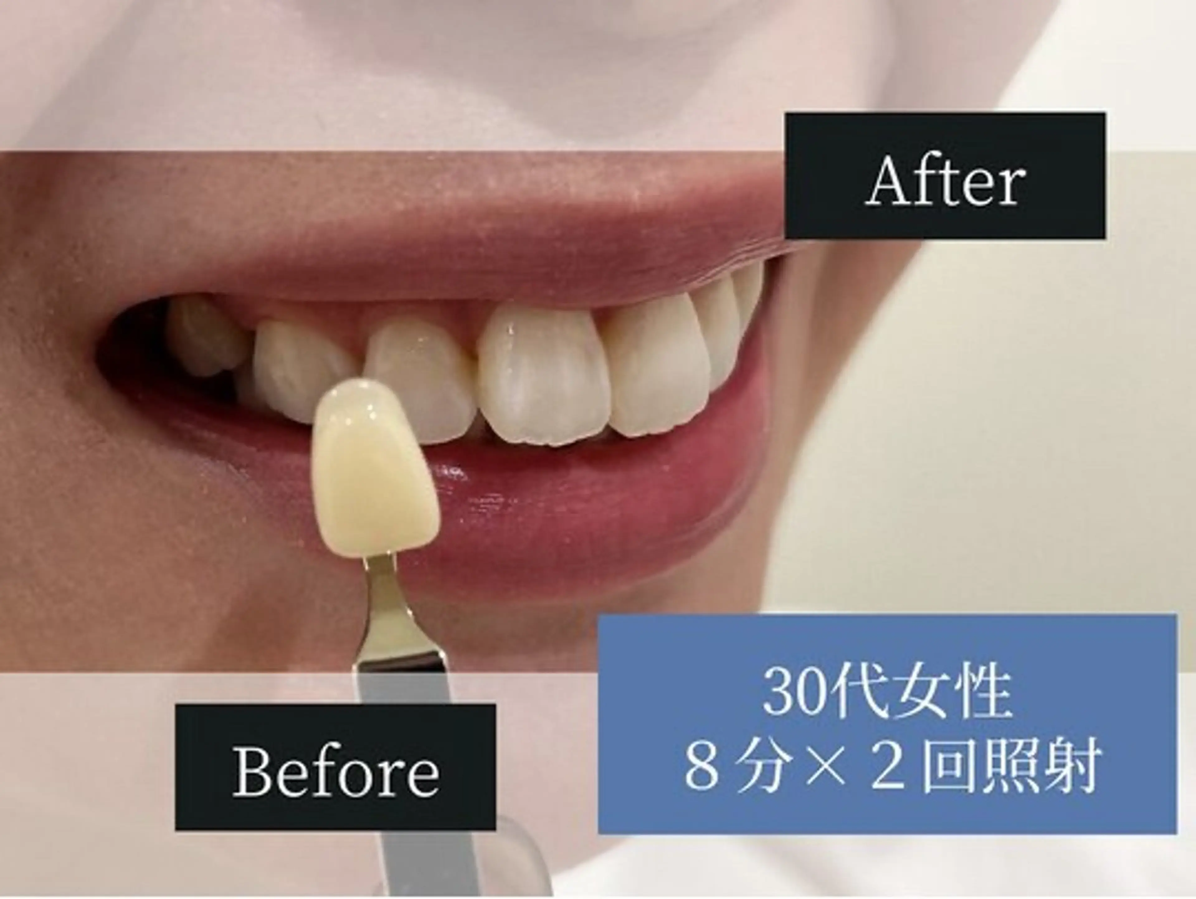 ホワイトニングカフェ 荻窪店のその他イメージ