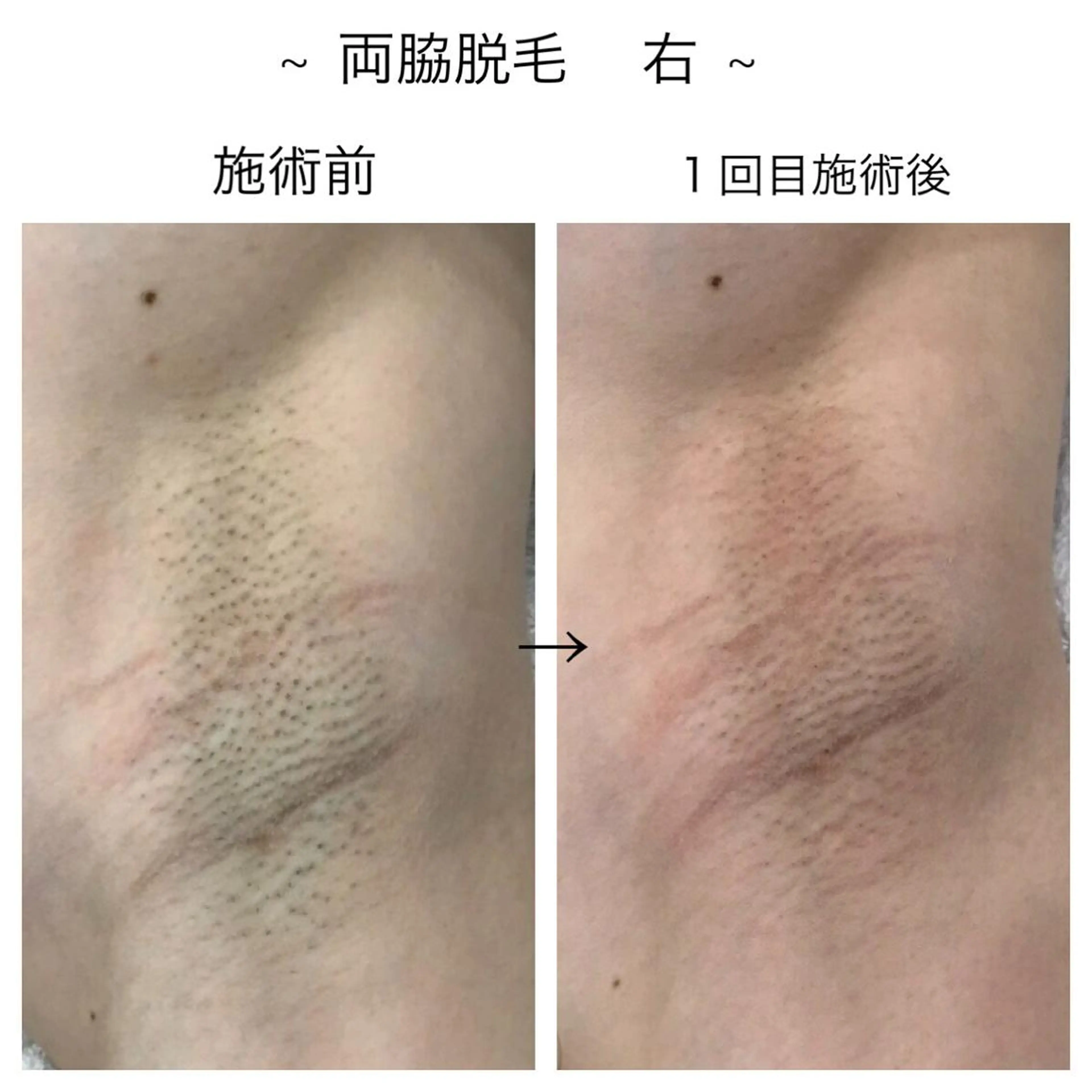 ビューティー ミロワールのエステ・リラクイメージ