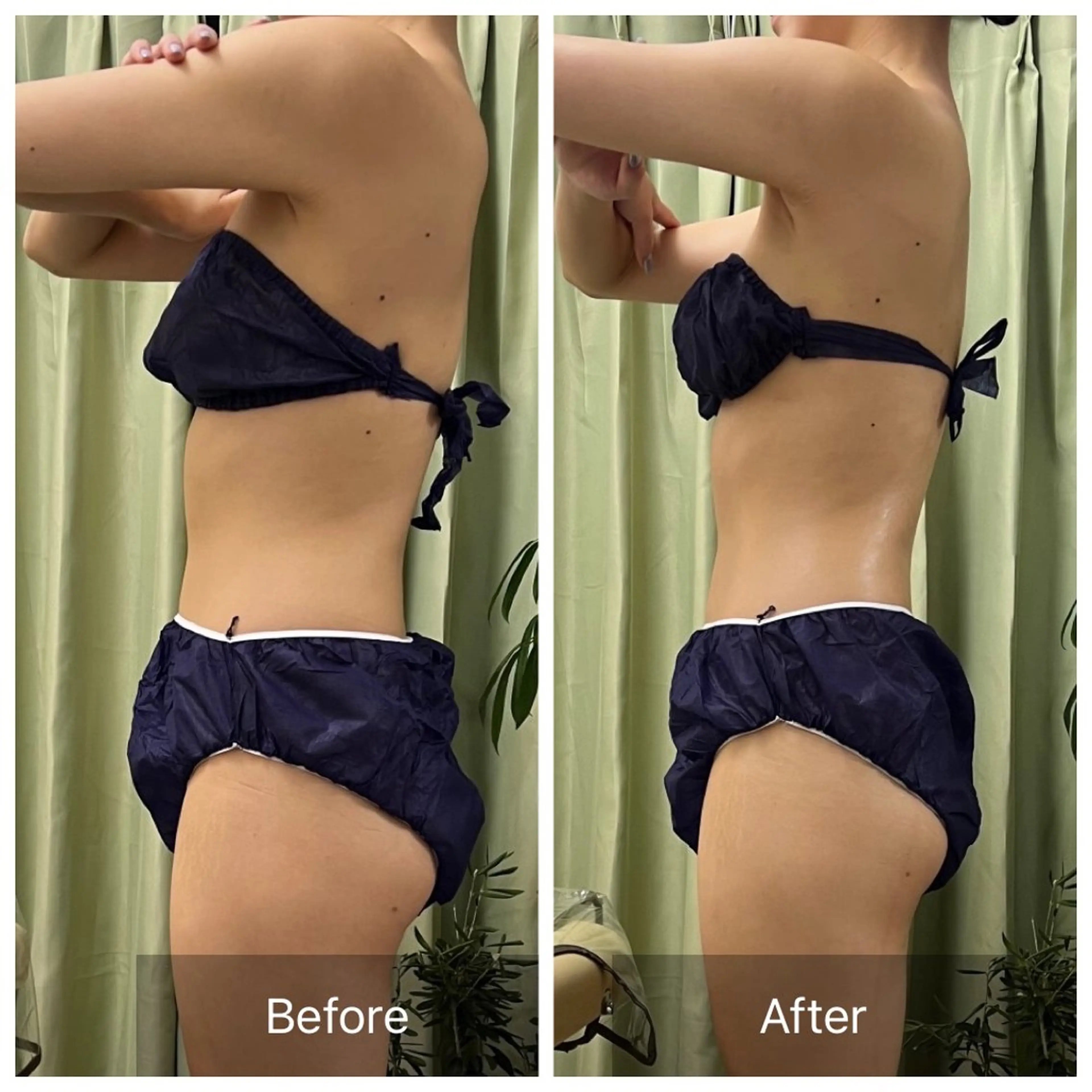 【2月限定】全員1度で"くびれ"ができる✨大切な予定の前に駆け込みケア🆗どんな方でも1回でサヨナラぽっこりお腹🔥の写真