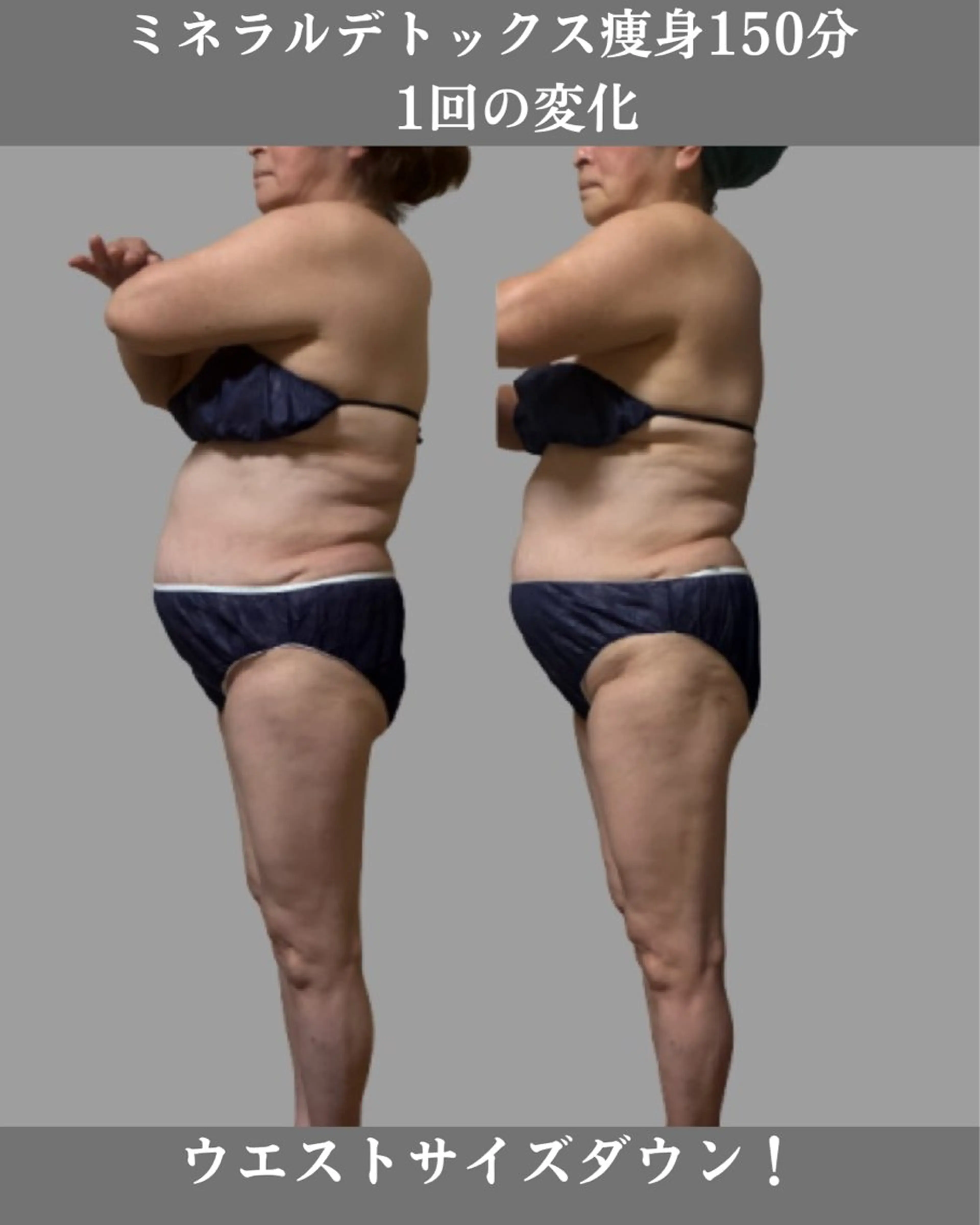 エステ デトックス×ボディメンテナンスサロンShikhara（シカラ）所属・オールハンド筋膜痩身 整体/小顔　中山朝美のエステ・リラクイメージ