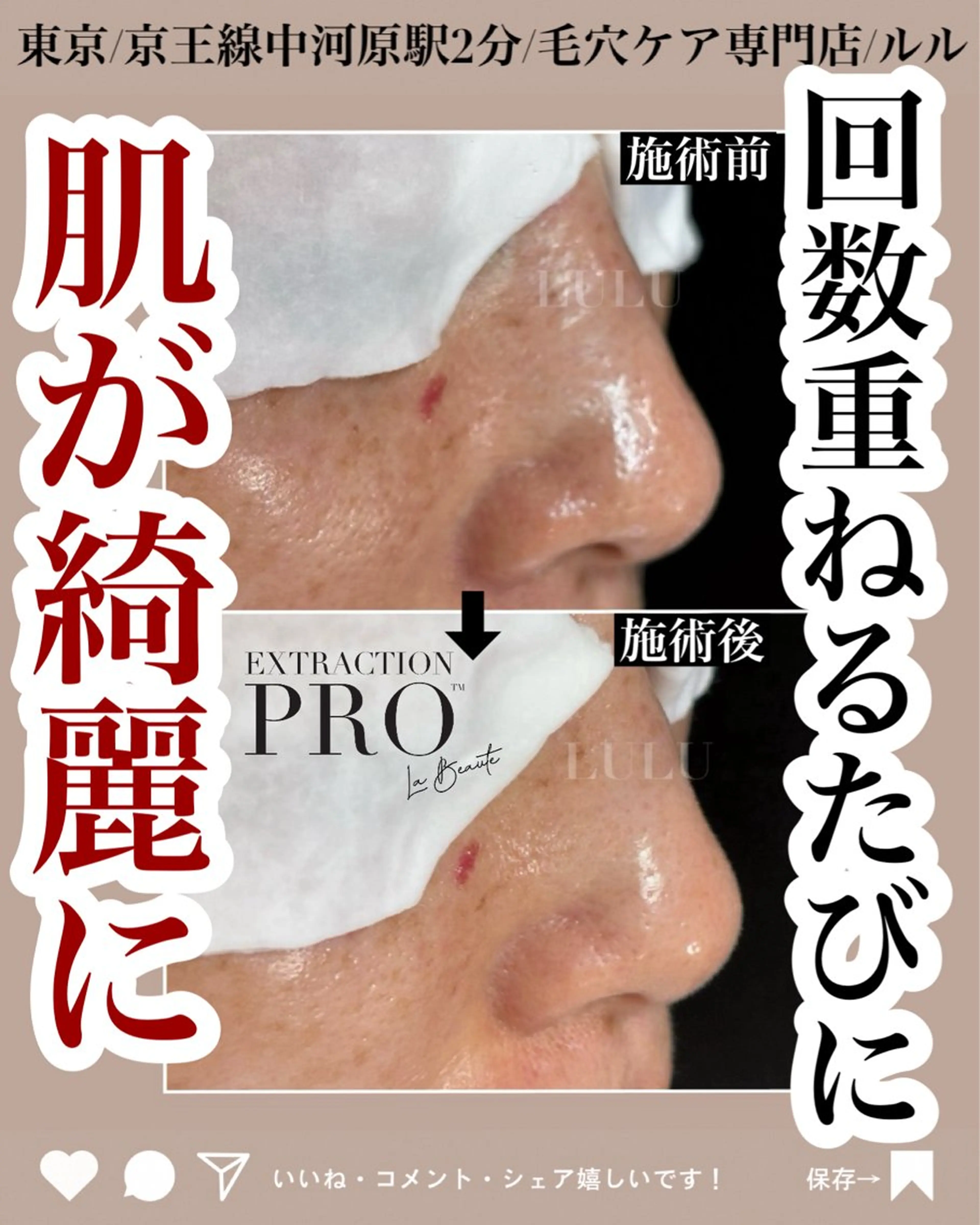 エステ LULU ルルのエステ・リラクイメージ