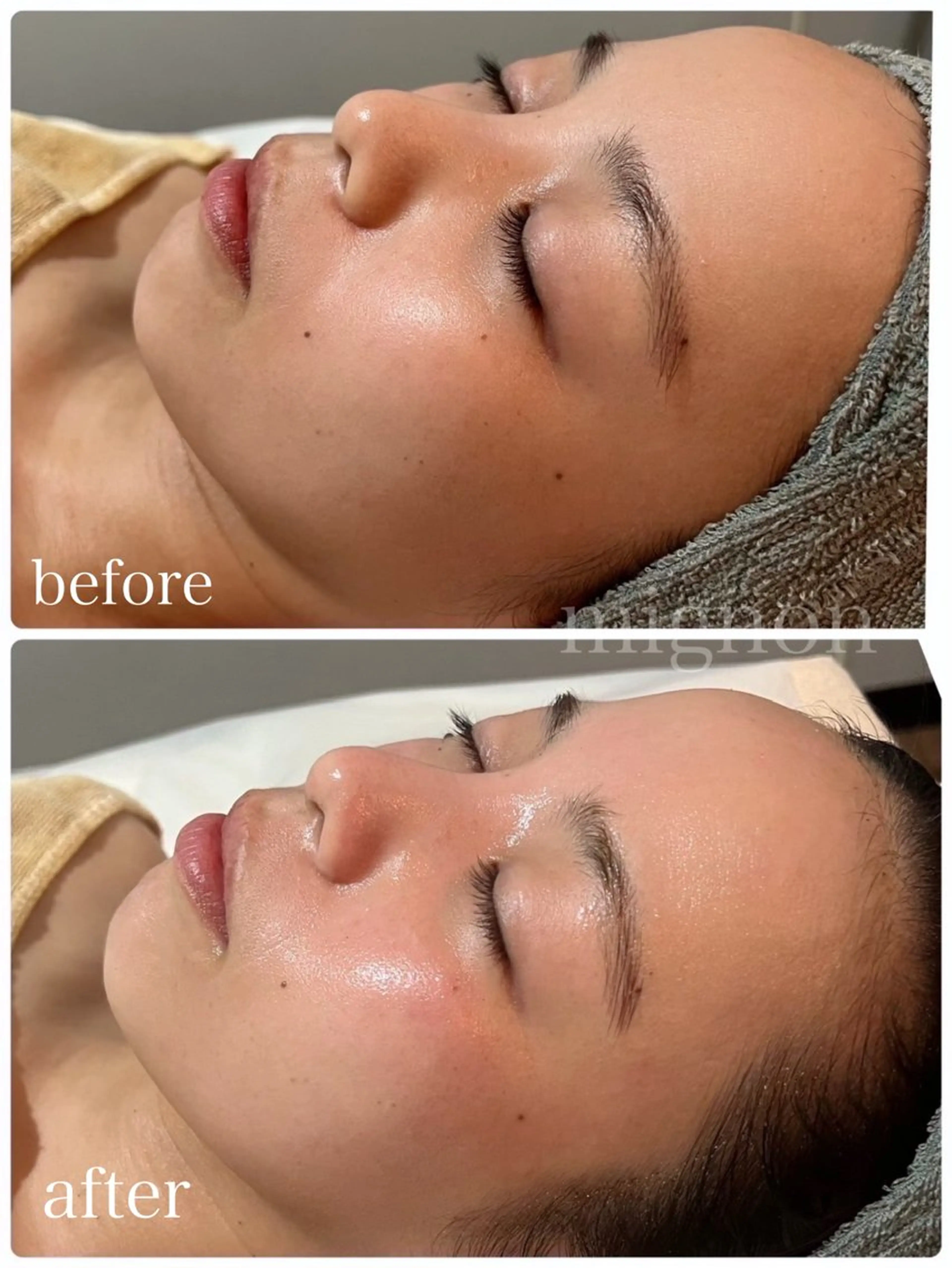 mignon /まつげパーマ・小顔のマツエク・マツパデザイン