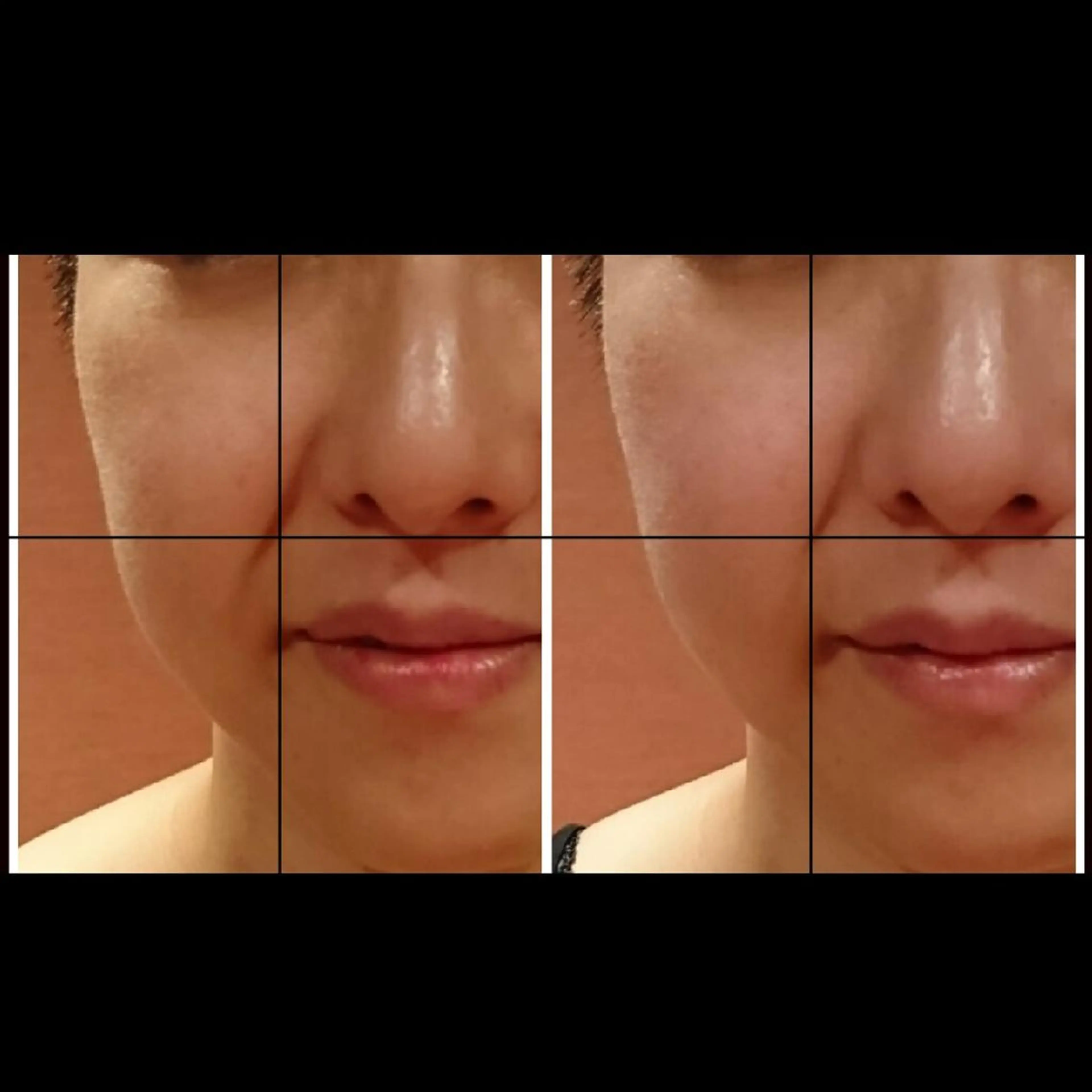 エステ リラク Nako  ﾅｺのエステ・リラクイメージ