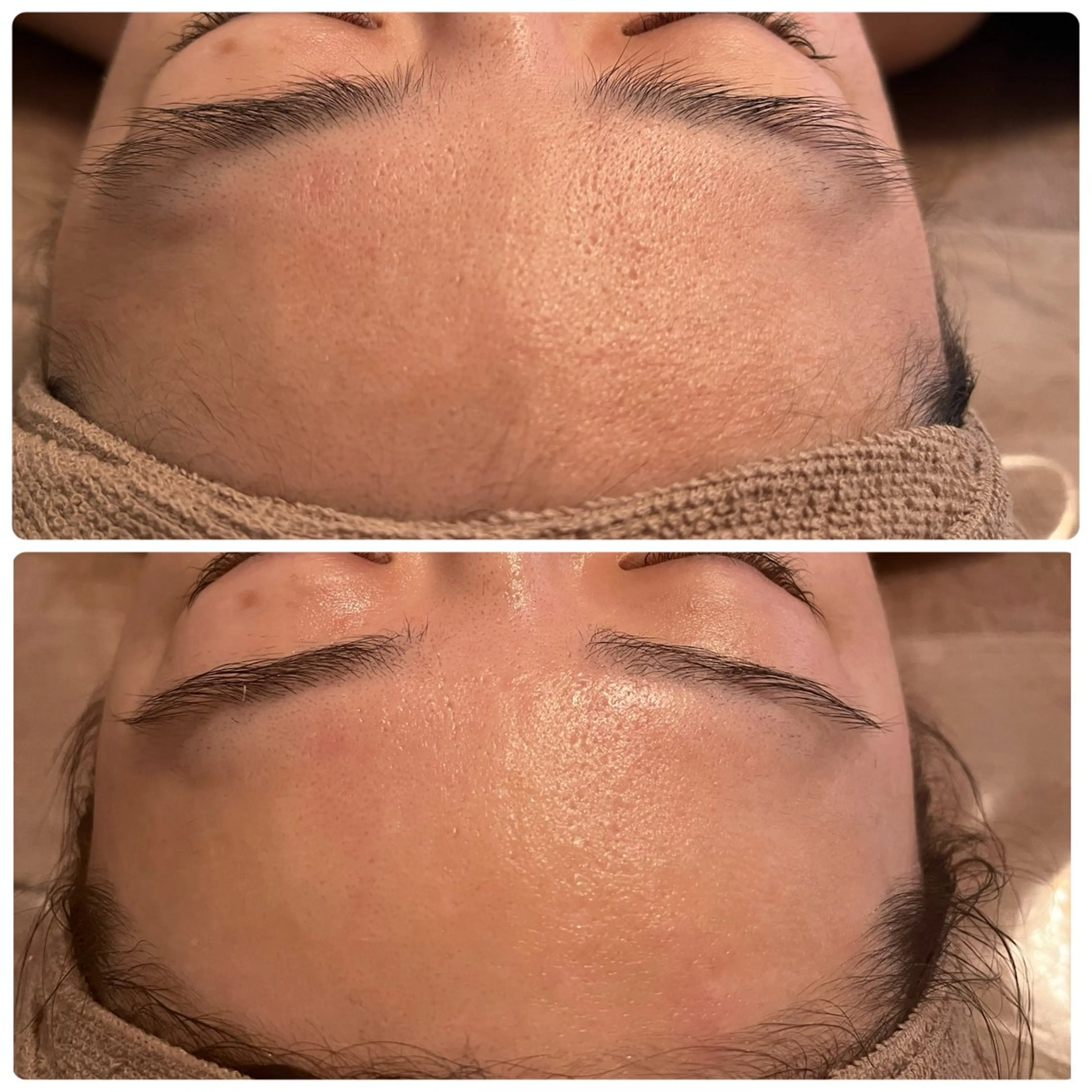 Ｂ&H所属・頭痛肩こり改善/小顔 サロンB&H心斎橋のエステ・リラクイメージ