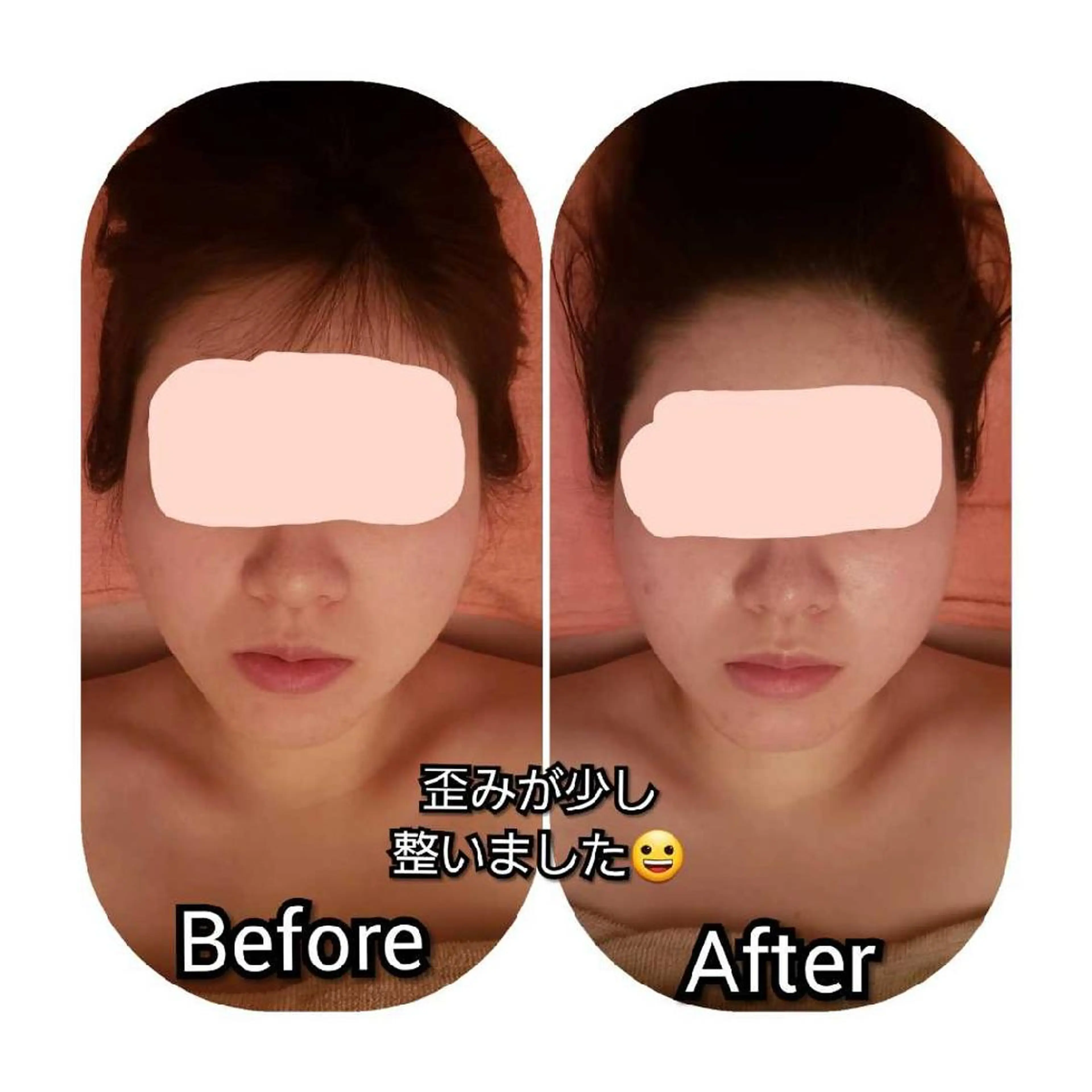 その他 毛穴ケア くすみ肌 ハーブピーリングのエステ・リラクイメージ