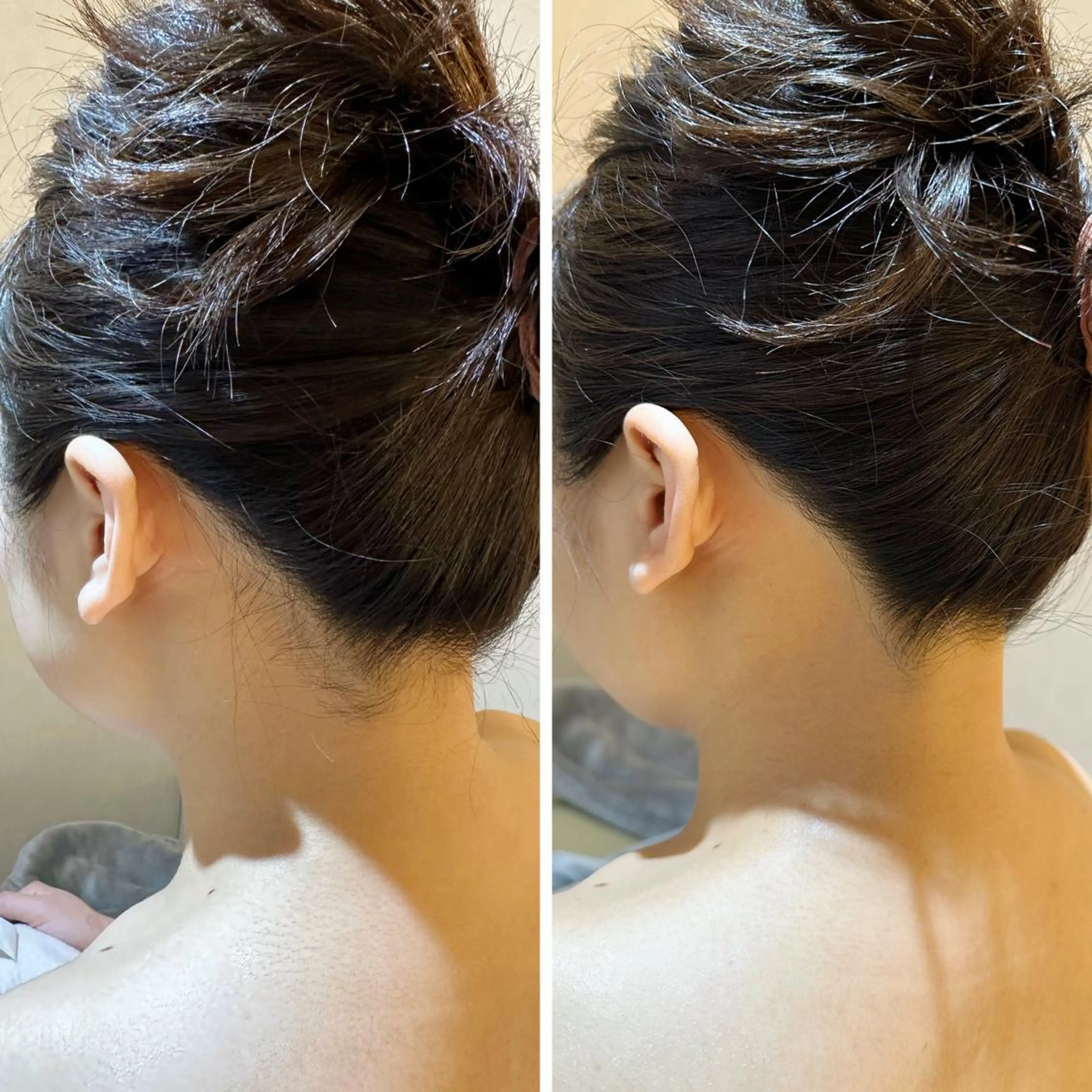 脱毛 うなじ脱毛/美肌脱毛 LABELのエステ・リラクイメージ