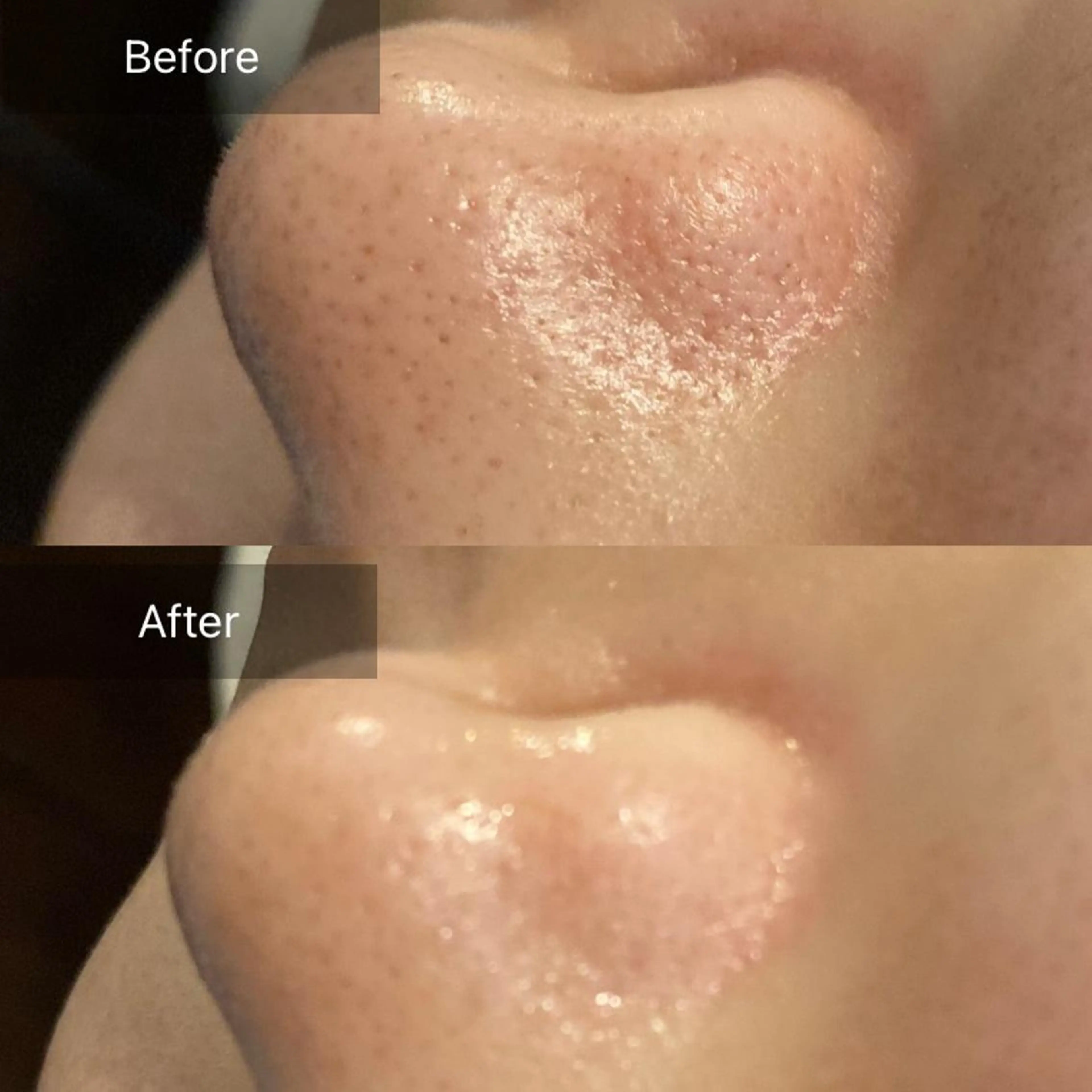 毛穴から始める肌メン テマンダリンオレンジのエステ・リラクイメージ