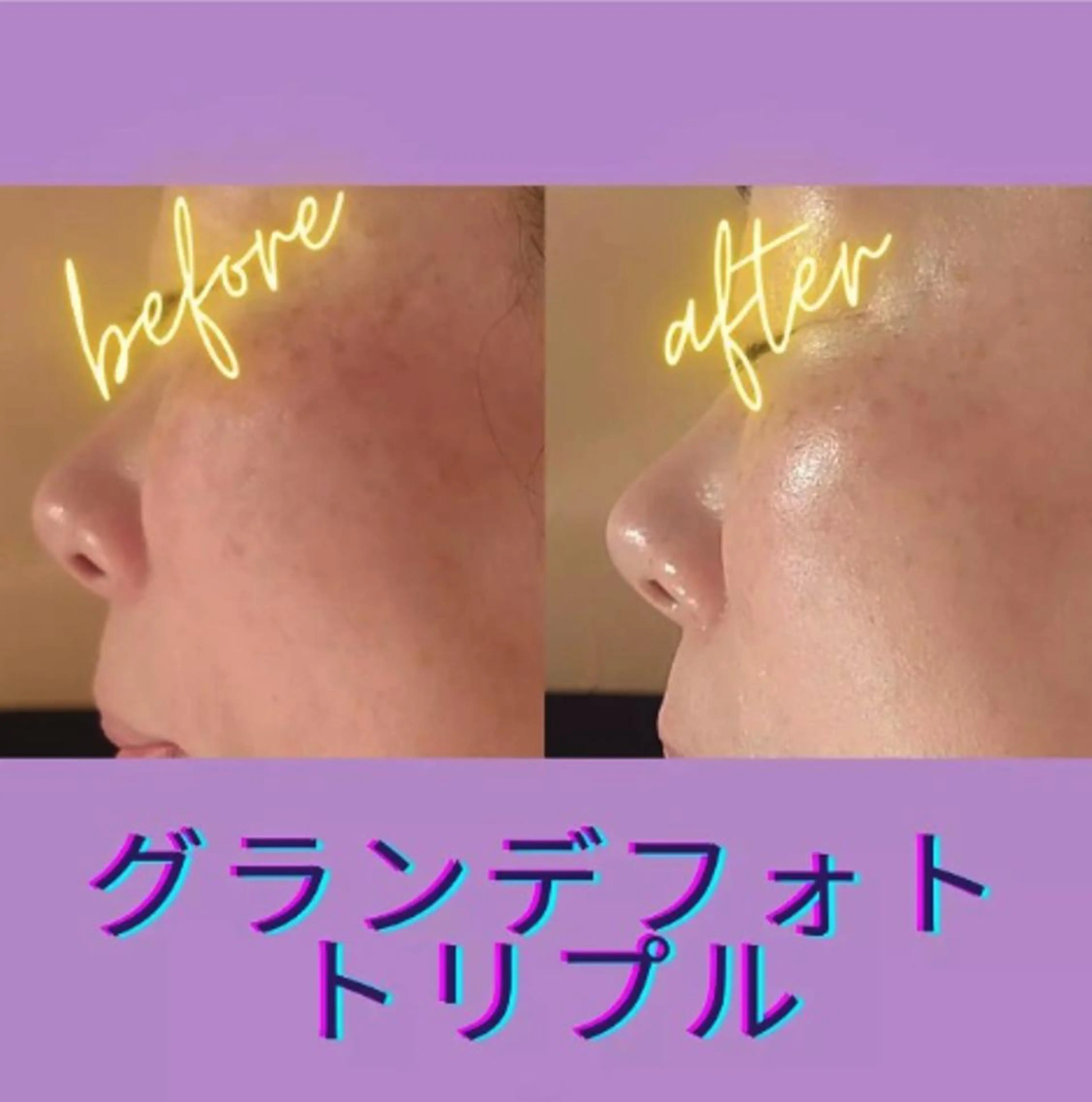 ラブニール 恵比寿店のエステ・リラクイメージ