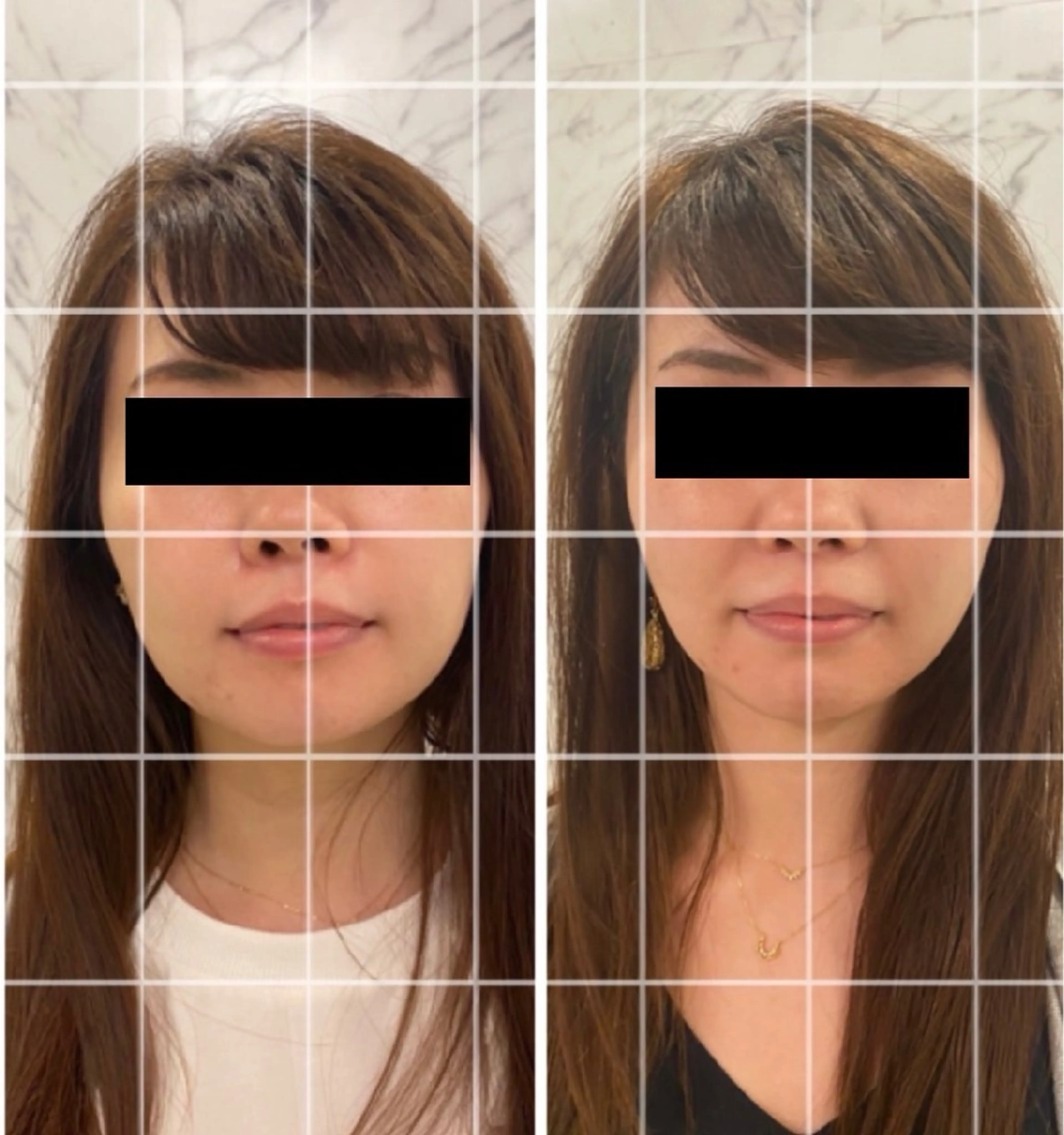 フェイシャル60分の写真