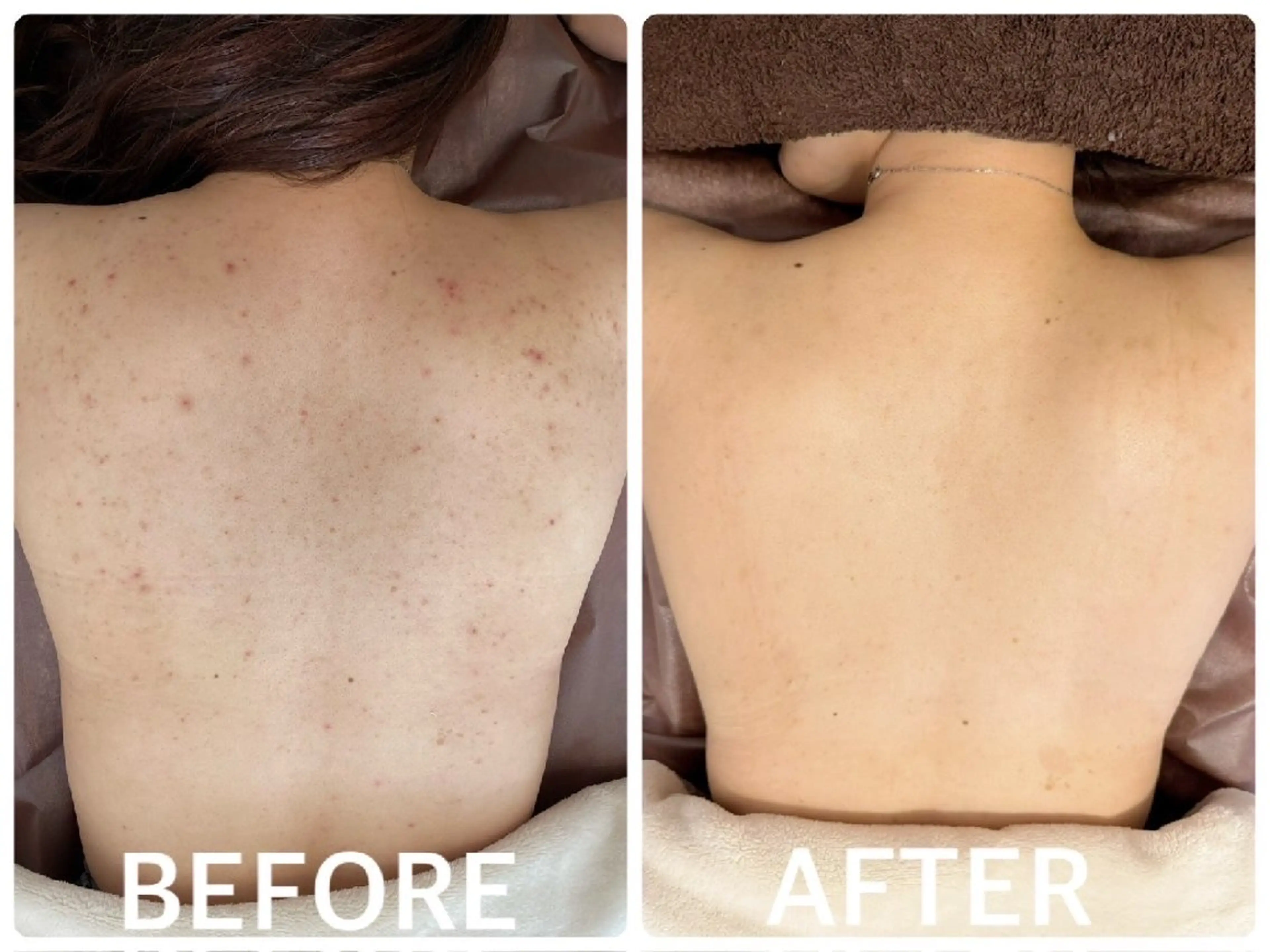 ハーブピーリング横浜 肌質改善専門店のその他イメージ