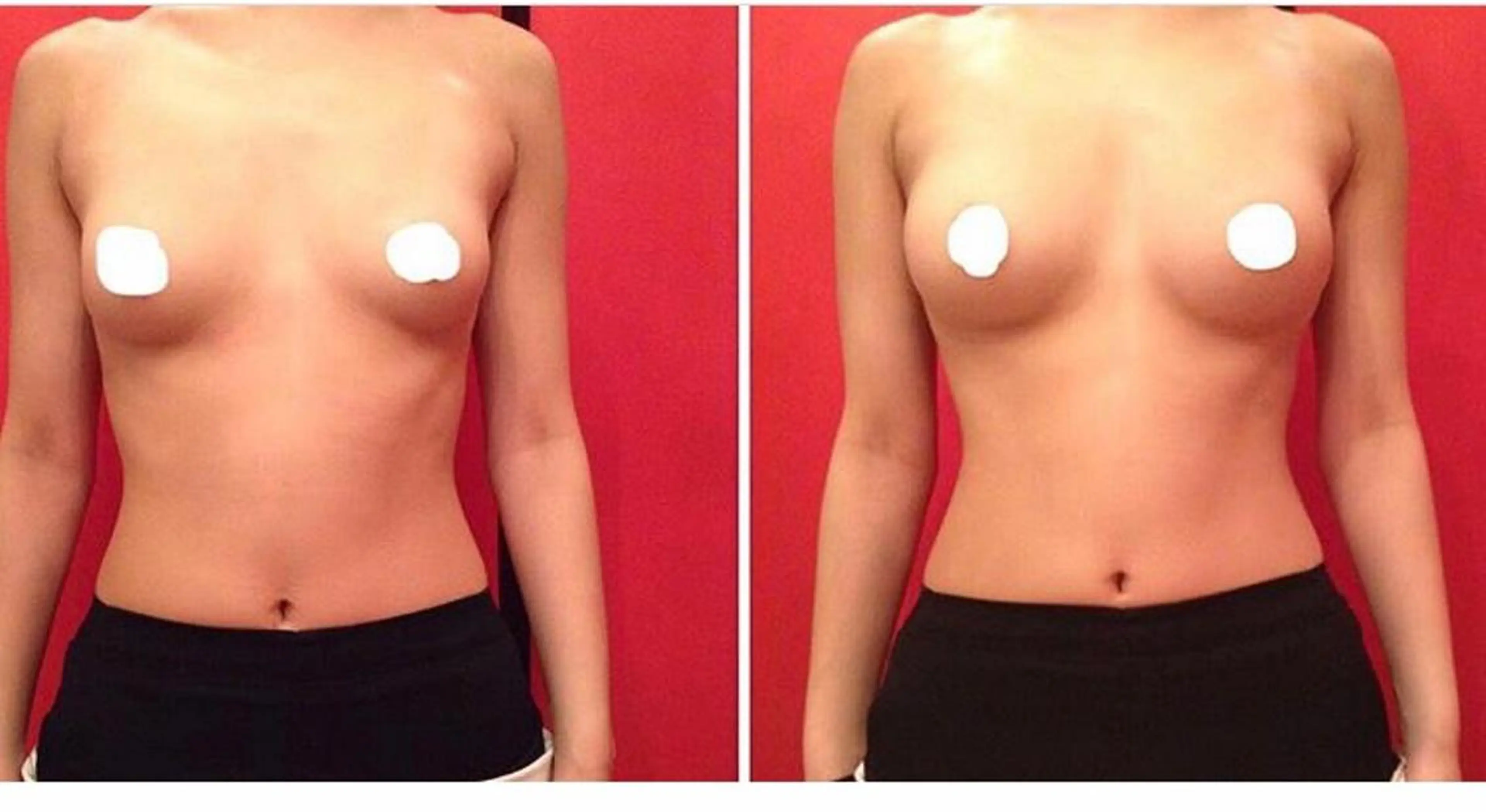 エステ バスト・脱毛・痩身 田中のエステ・リラクイメージ