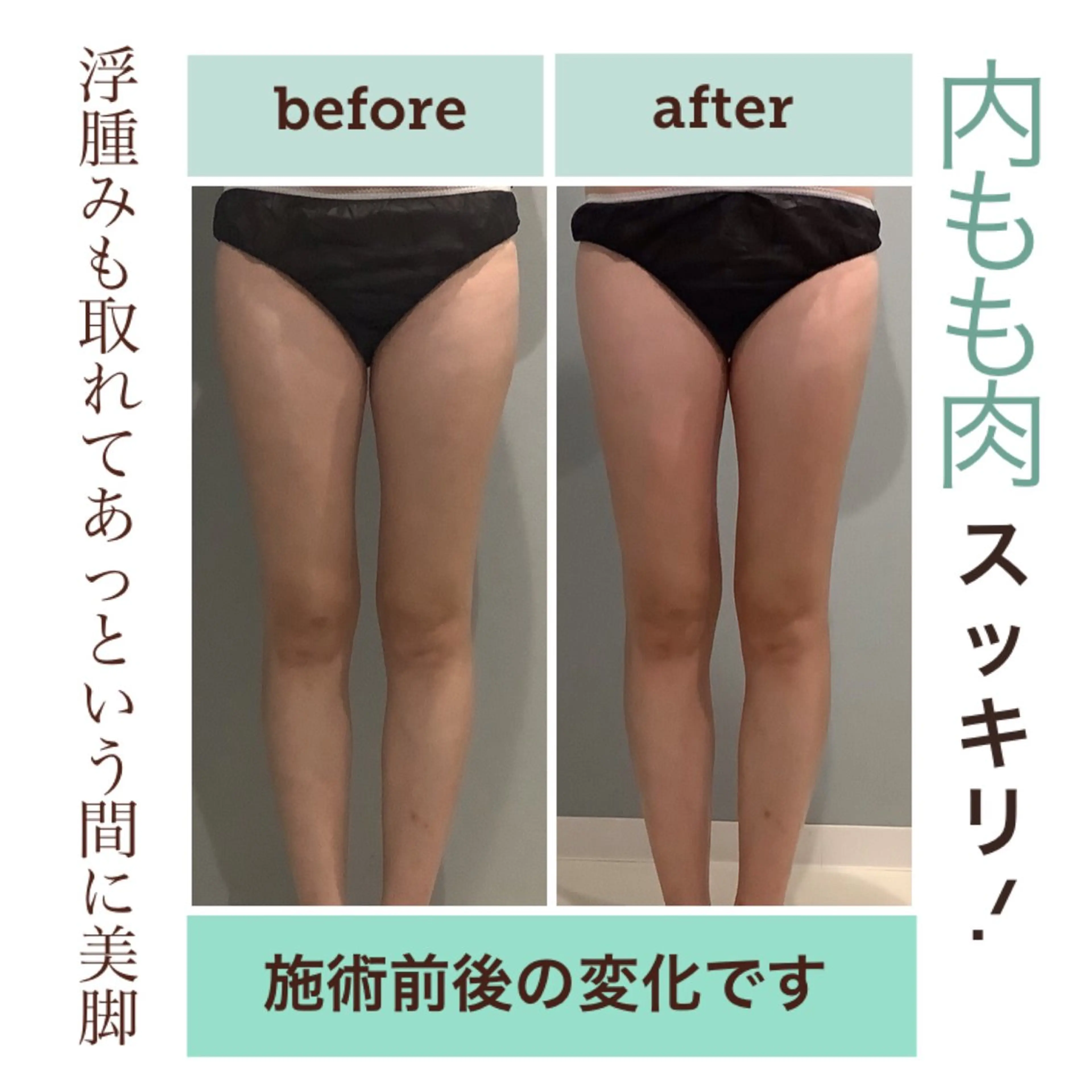 エステ エステサロン JURISのエステ・リラクイメージ