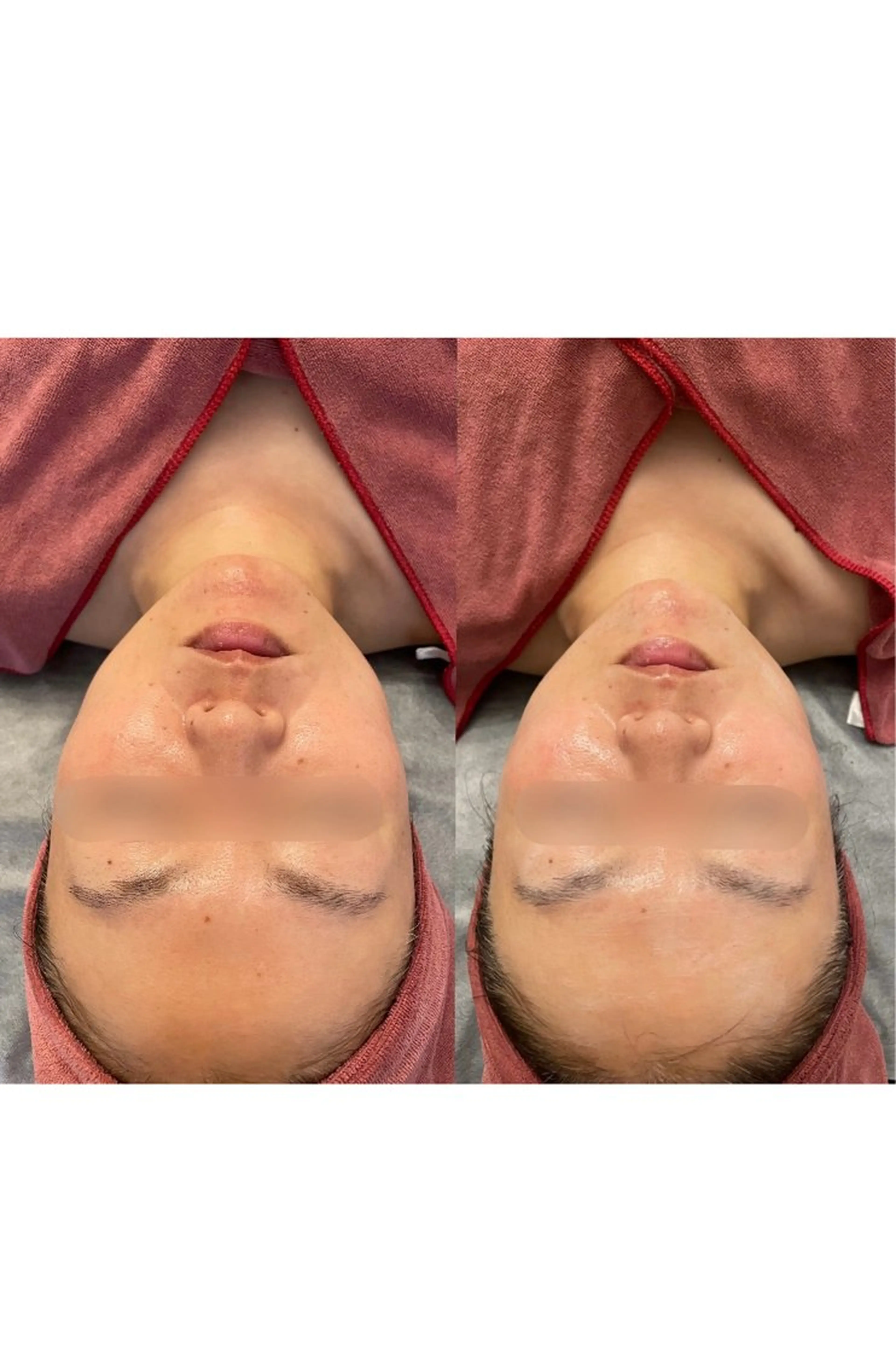 ニキビ/疲労回復ケア シェソワのエステ・リラクイメージ