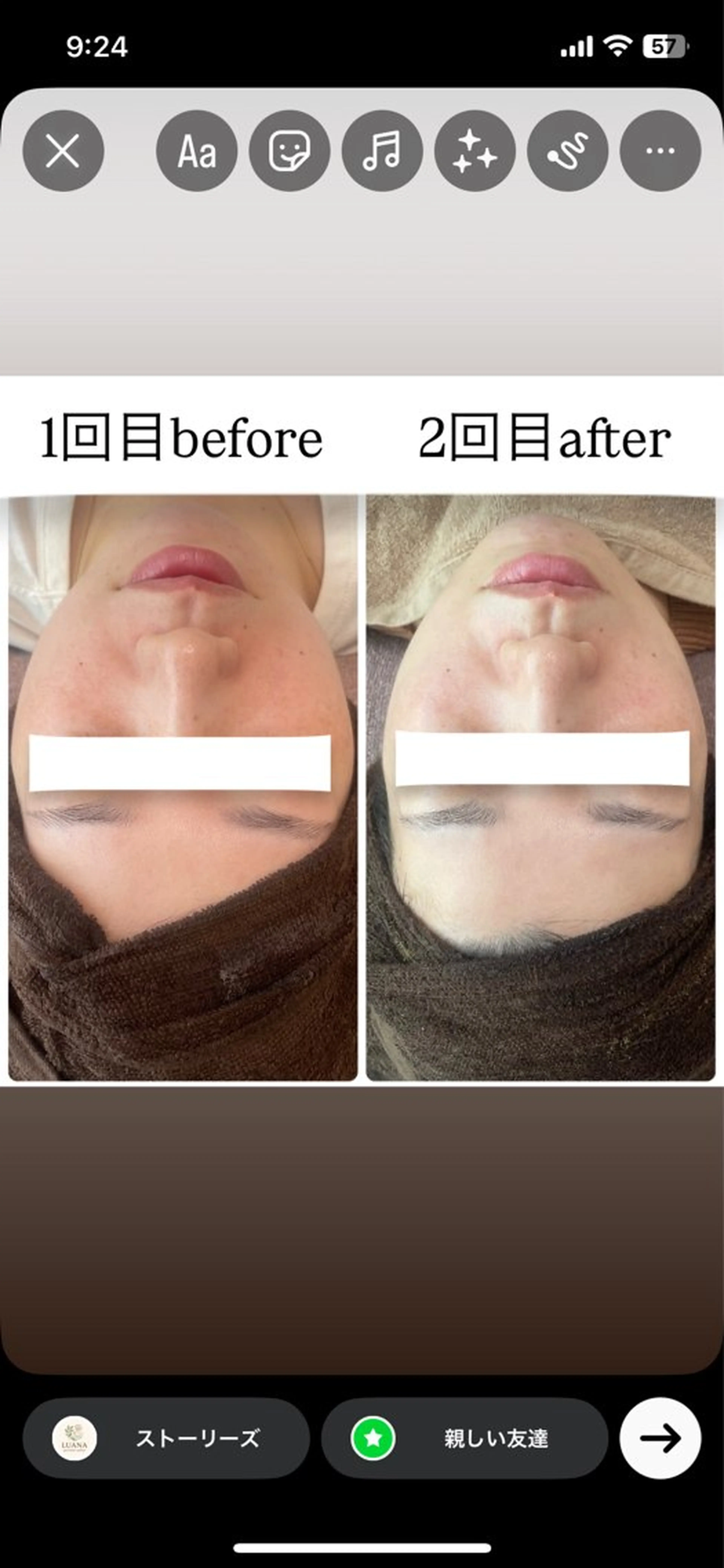 エステ ルアナ プライベートサロンのネイルデザイン