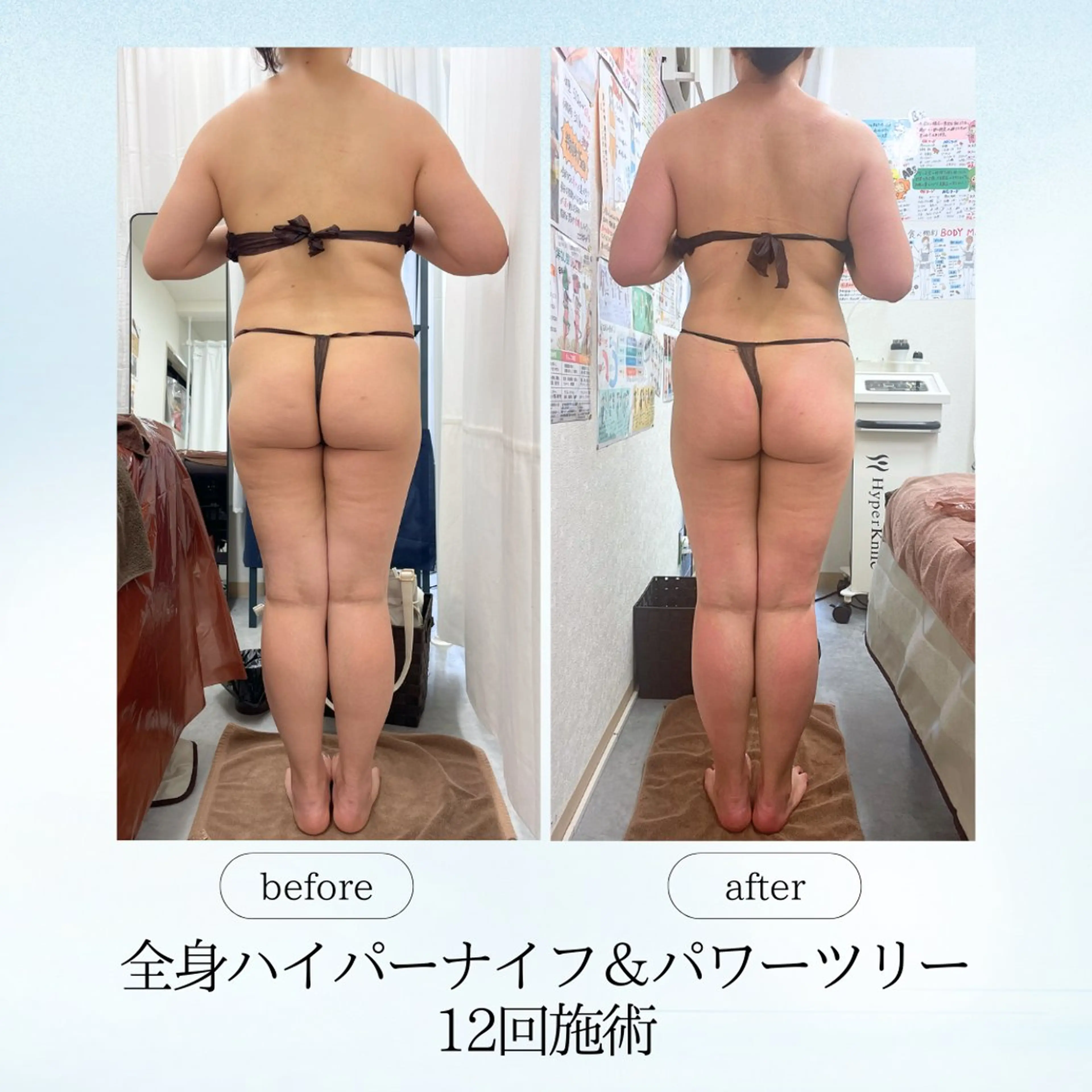 エステ リラク 《痩身、小顔専門店》 エスプレッソのエステ・リラクイメージ