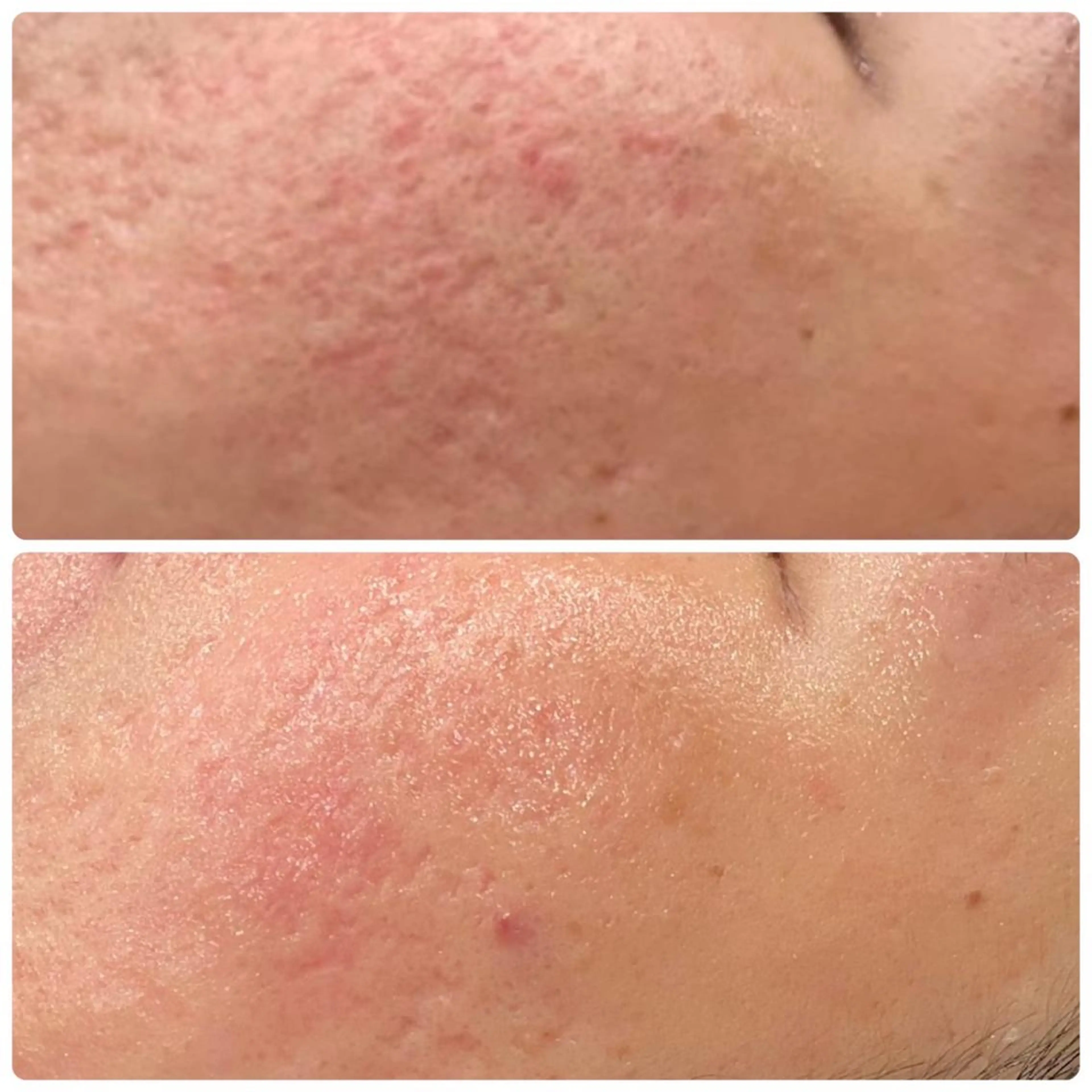 エステ Gemini MIKIのエステ・リラクイメージ