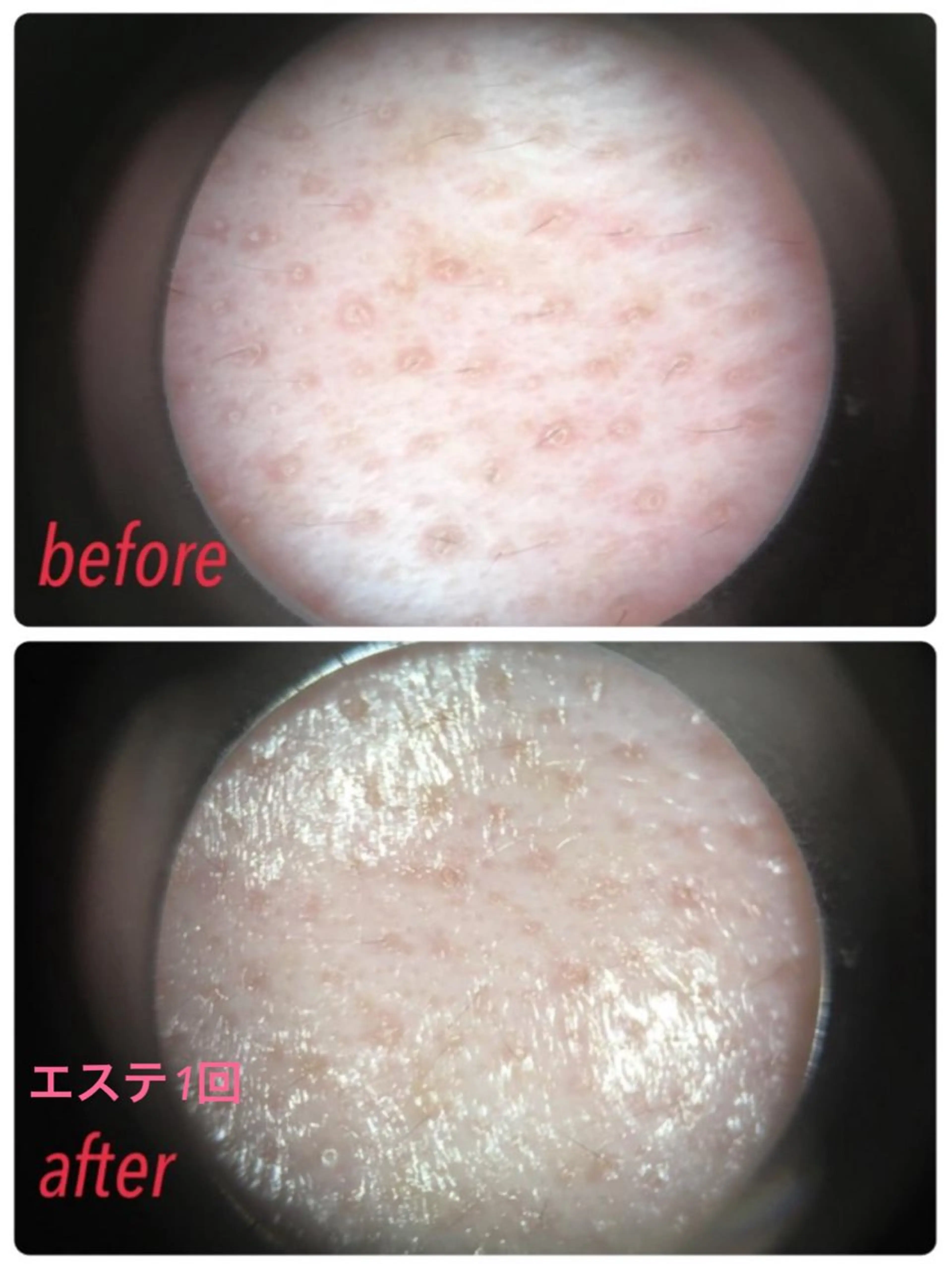 メナードフェイシャルサロン岐阜桜通所属・大橋 あつこのエステ・リラクイメージ