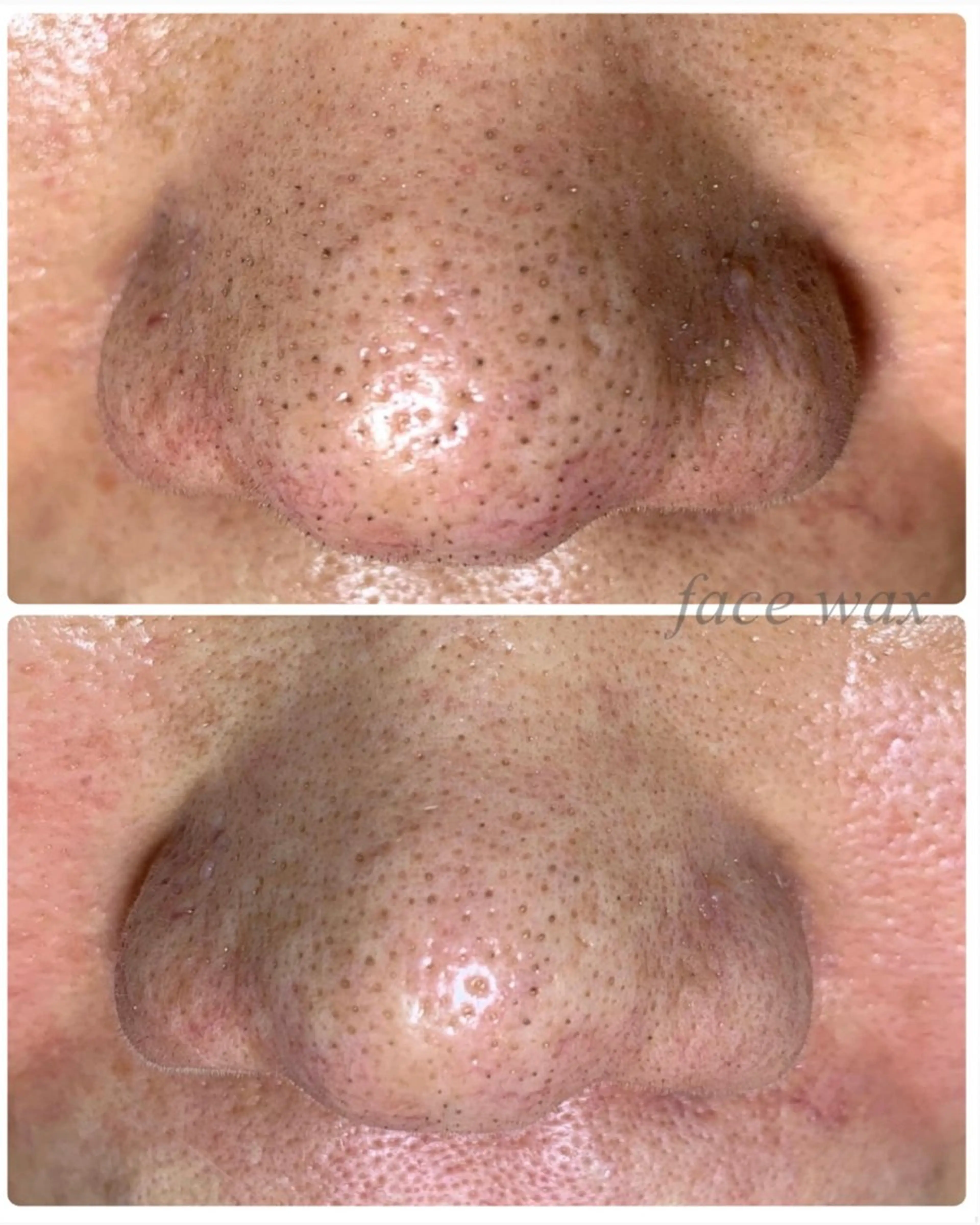 江洲 Vibliss ｳﾞｨﾌﾞﾘｽのマツエク・マツパデザイン