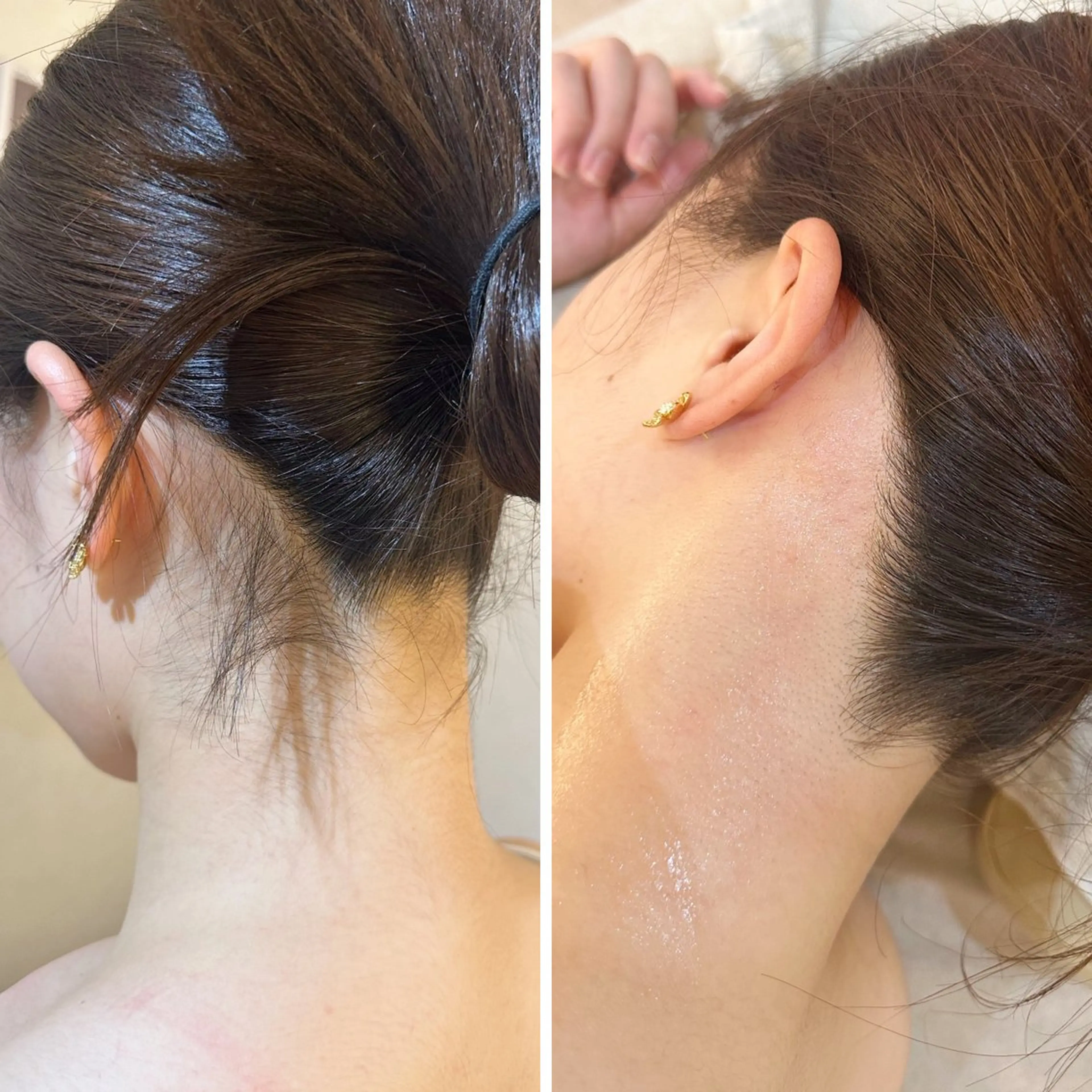 脱毛 うなじ脱毛/美肌脱毛 LABELのエステ・リラクイメージ