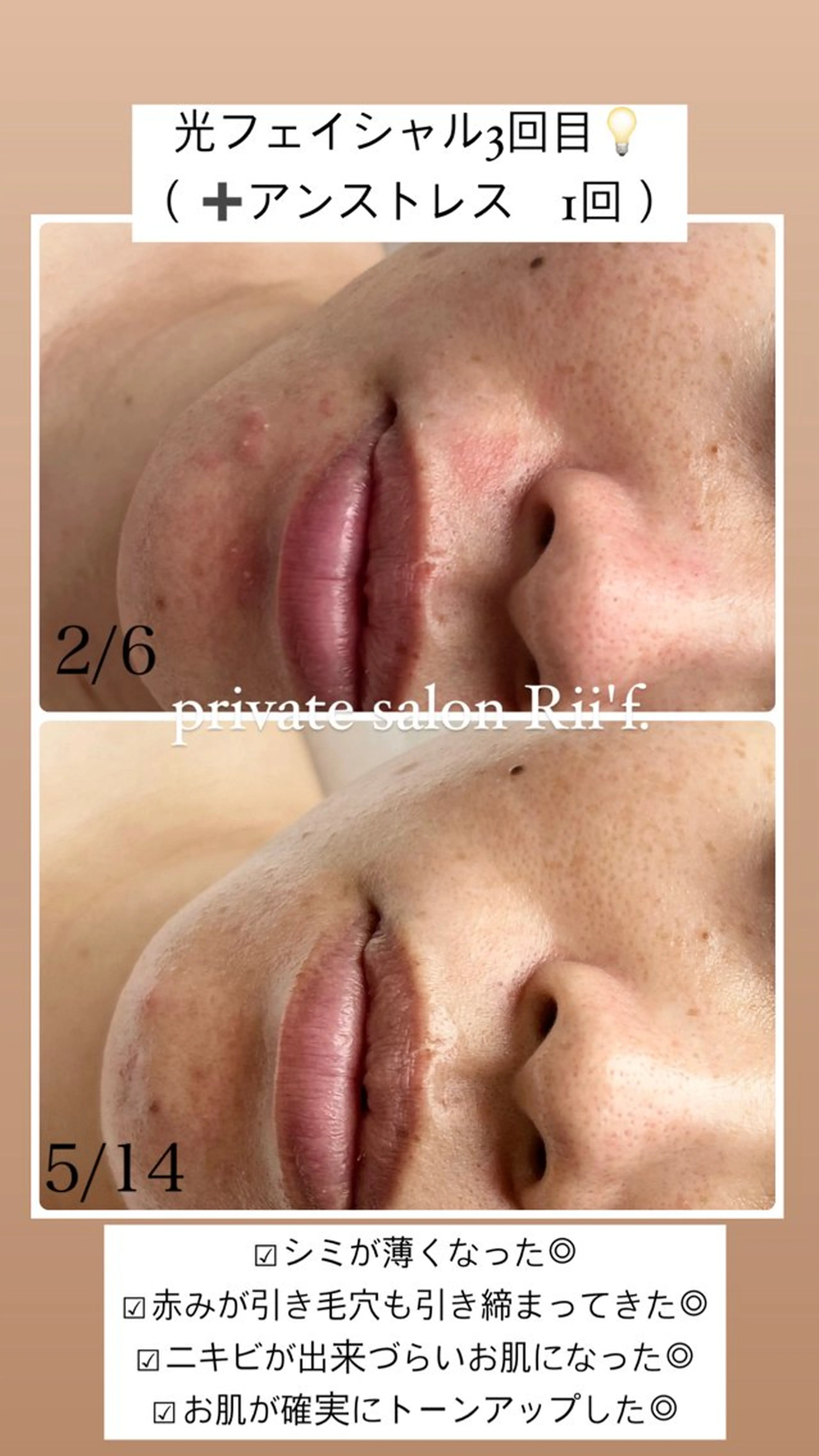 エステ private sa lon Rii'f.のエステ・リラクイメージ