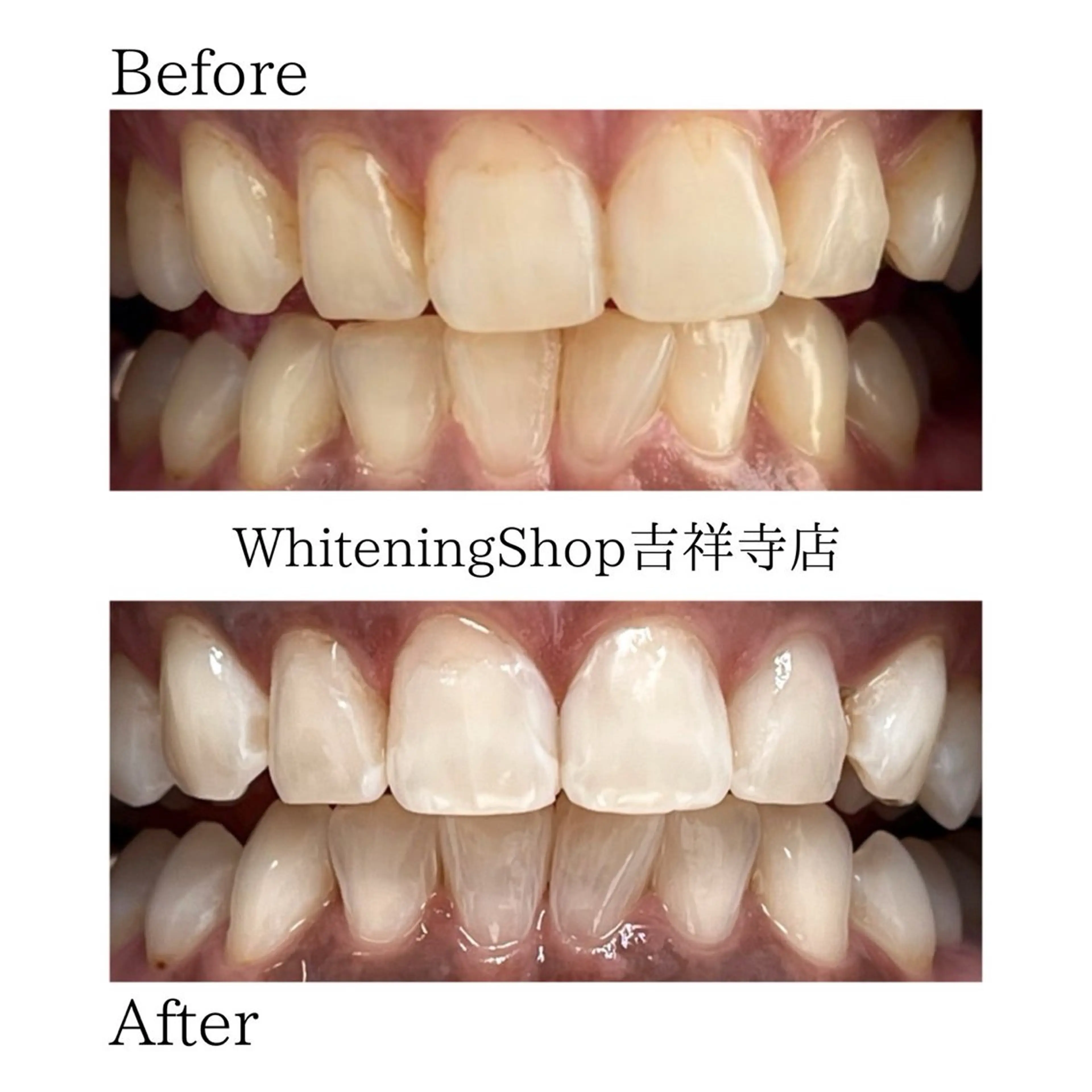 エステ リラク ホワイトニング ショップ吉祥寺店のエステ・リラクイメージ