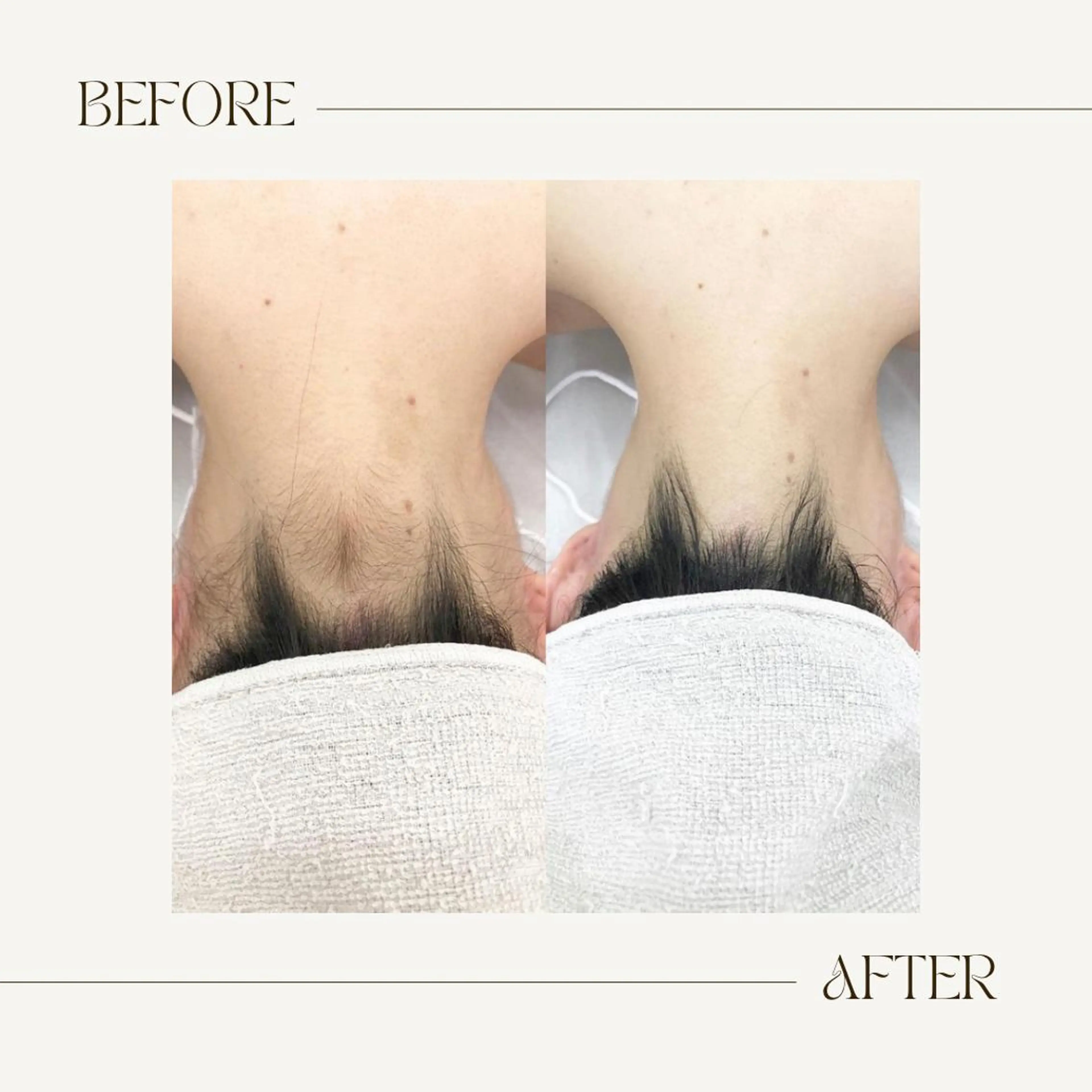 脱毛 脱毛専門サロンELIXIR（ｴﾘｸｻｰ）所属・脱毛&ホワイトニング ELIXIR×ULTのエステ・リラクイメージ