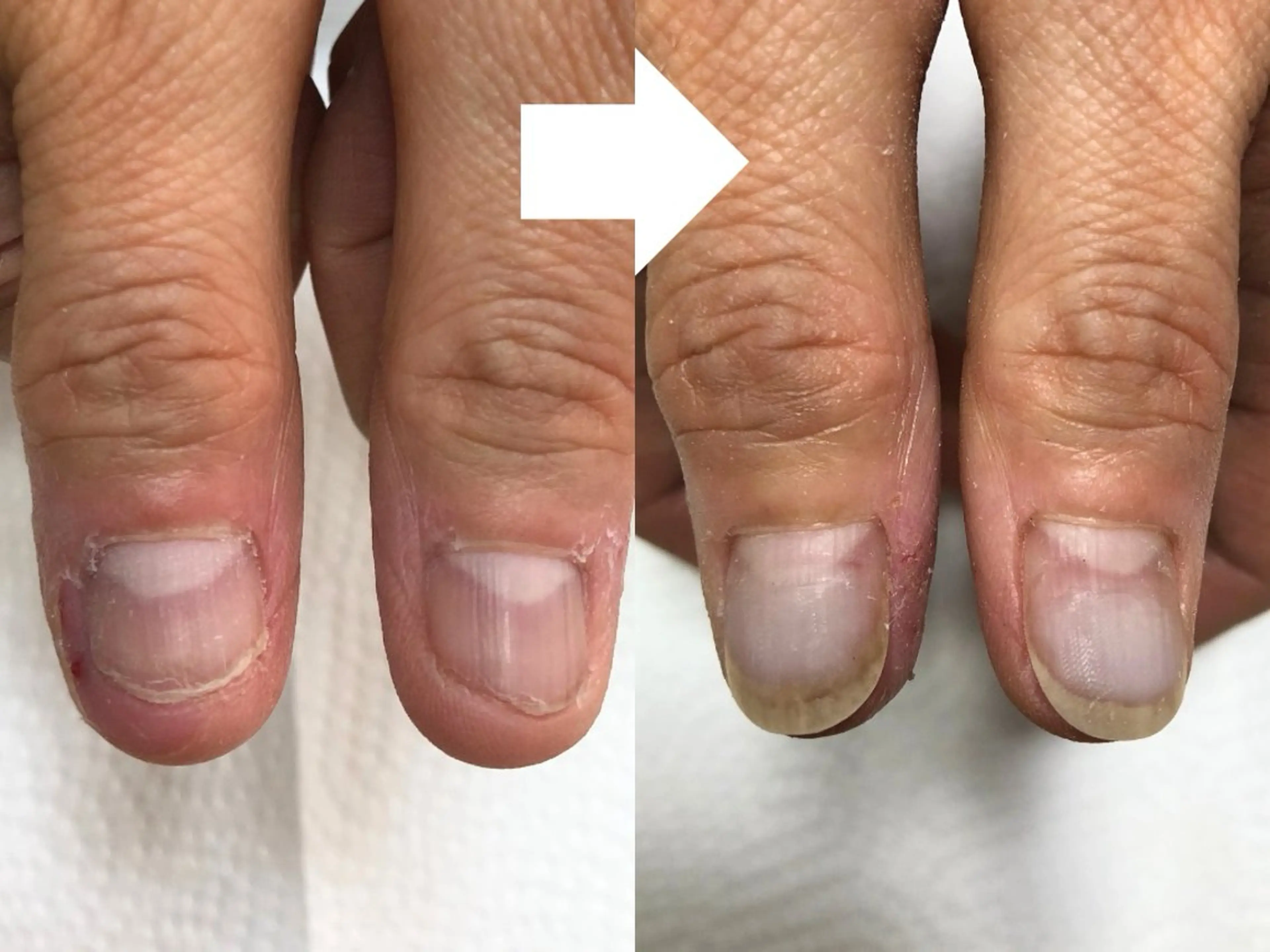 深爪矯正専門サロン リュリュのネイルデザイン