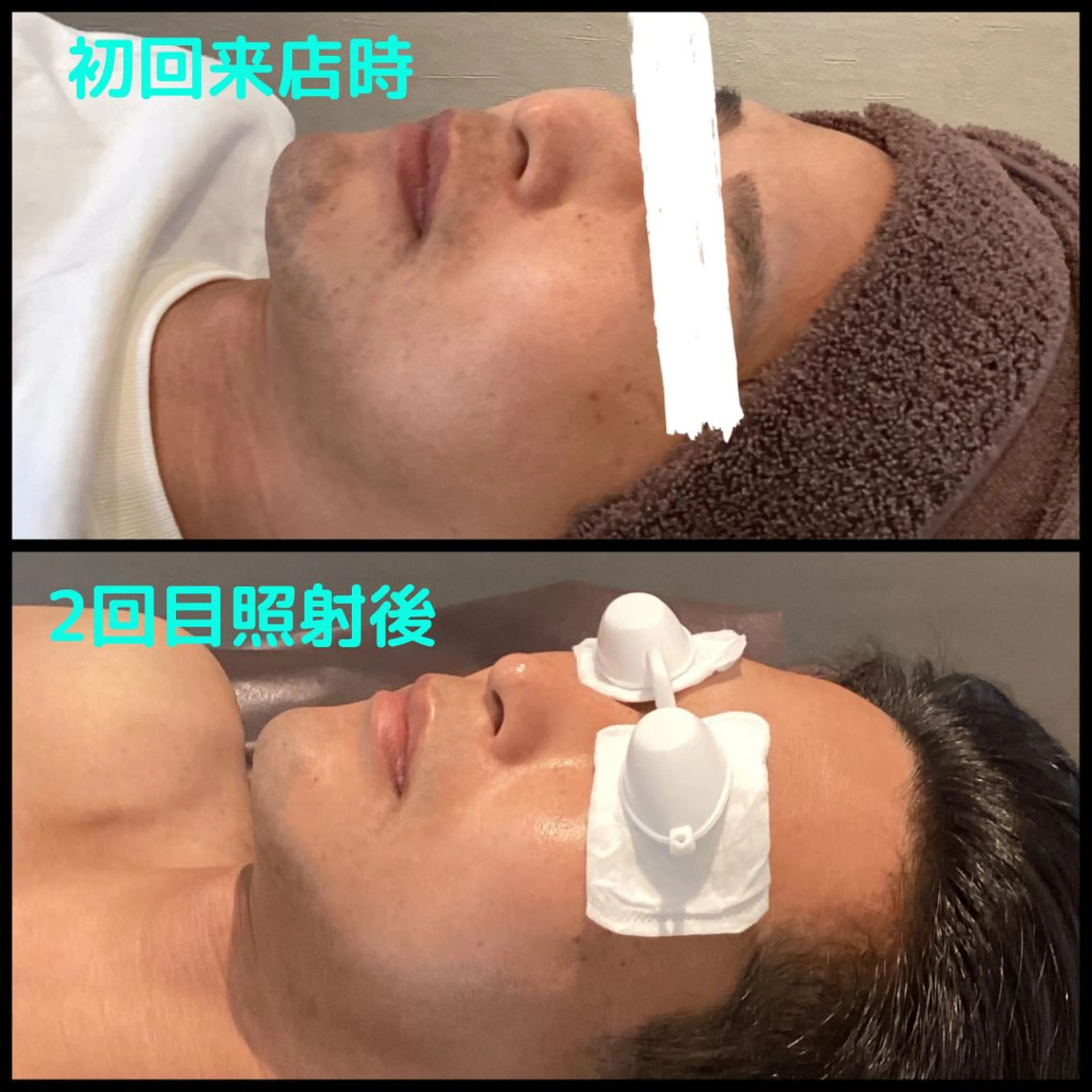 メンズ メンズ脱毛ECXIA所属・men's脱毛サロン ECXIAのエステ・リラクイメージ