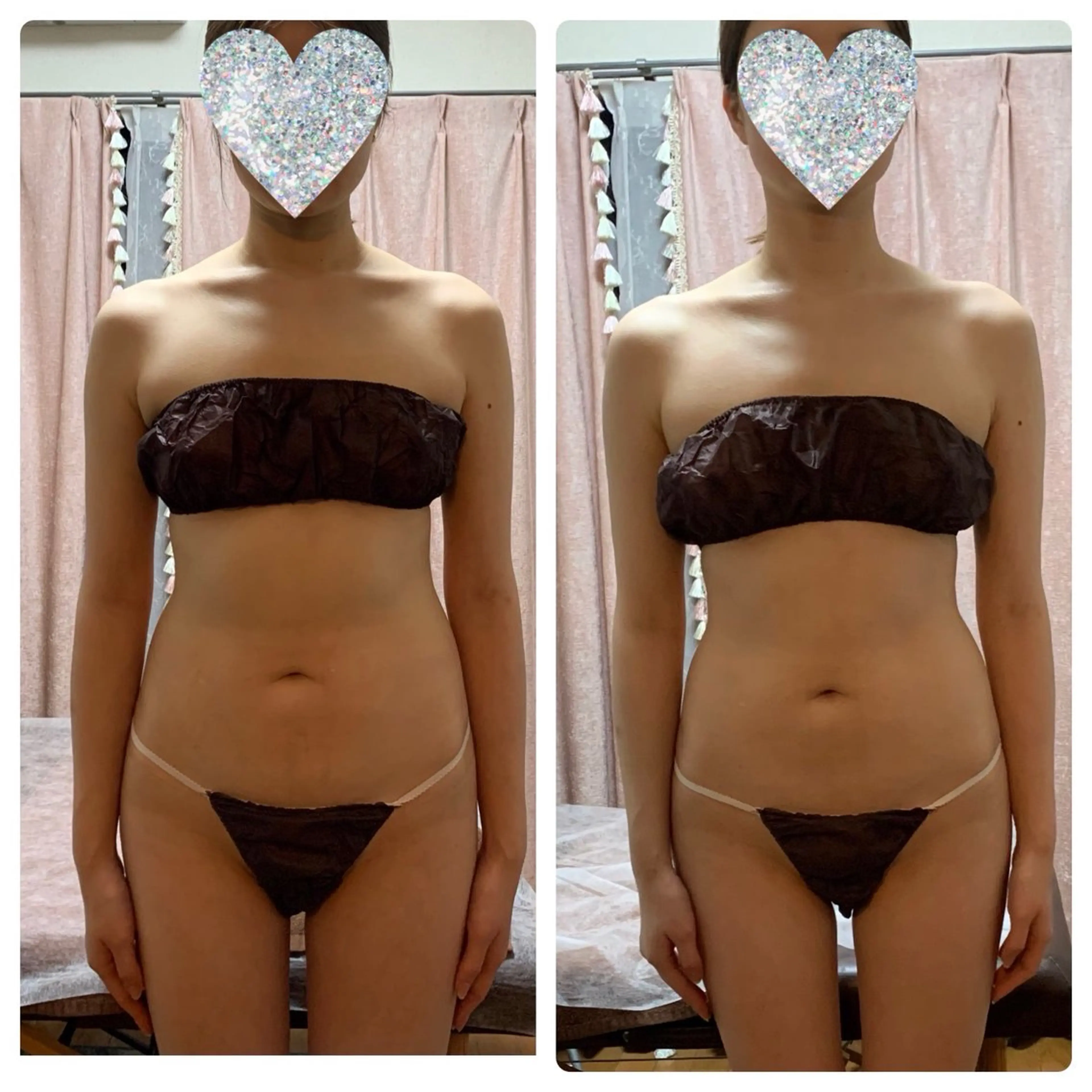 脱毛 フェイシャル soin～ソワン～のエステ・リラクイメージ