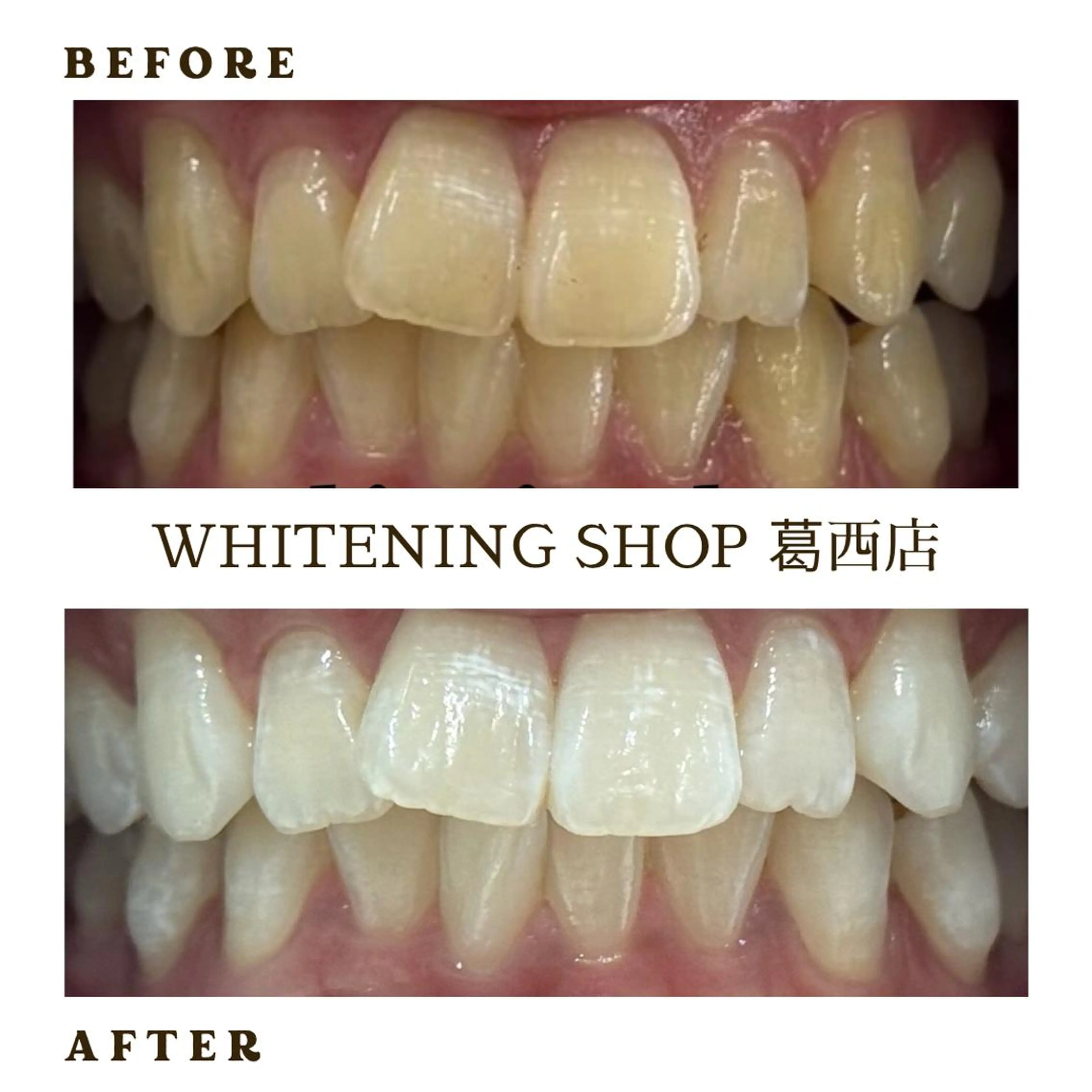 メンズ その他 ホワイトニング ショップ葛西店のその他イメージ