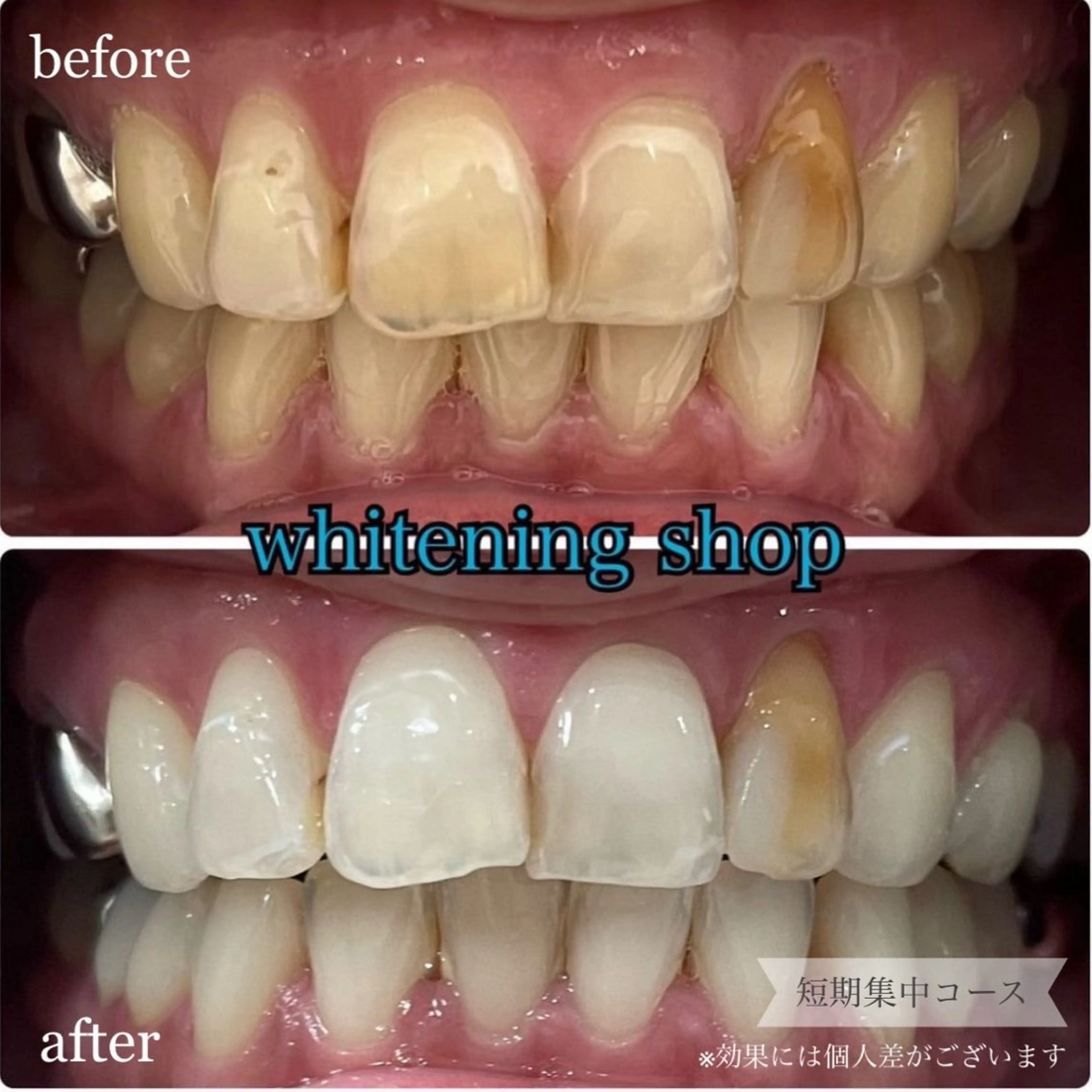 ホワイトニング ショップ桜木町店のエステ・リラクイメージ