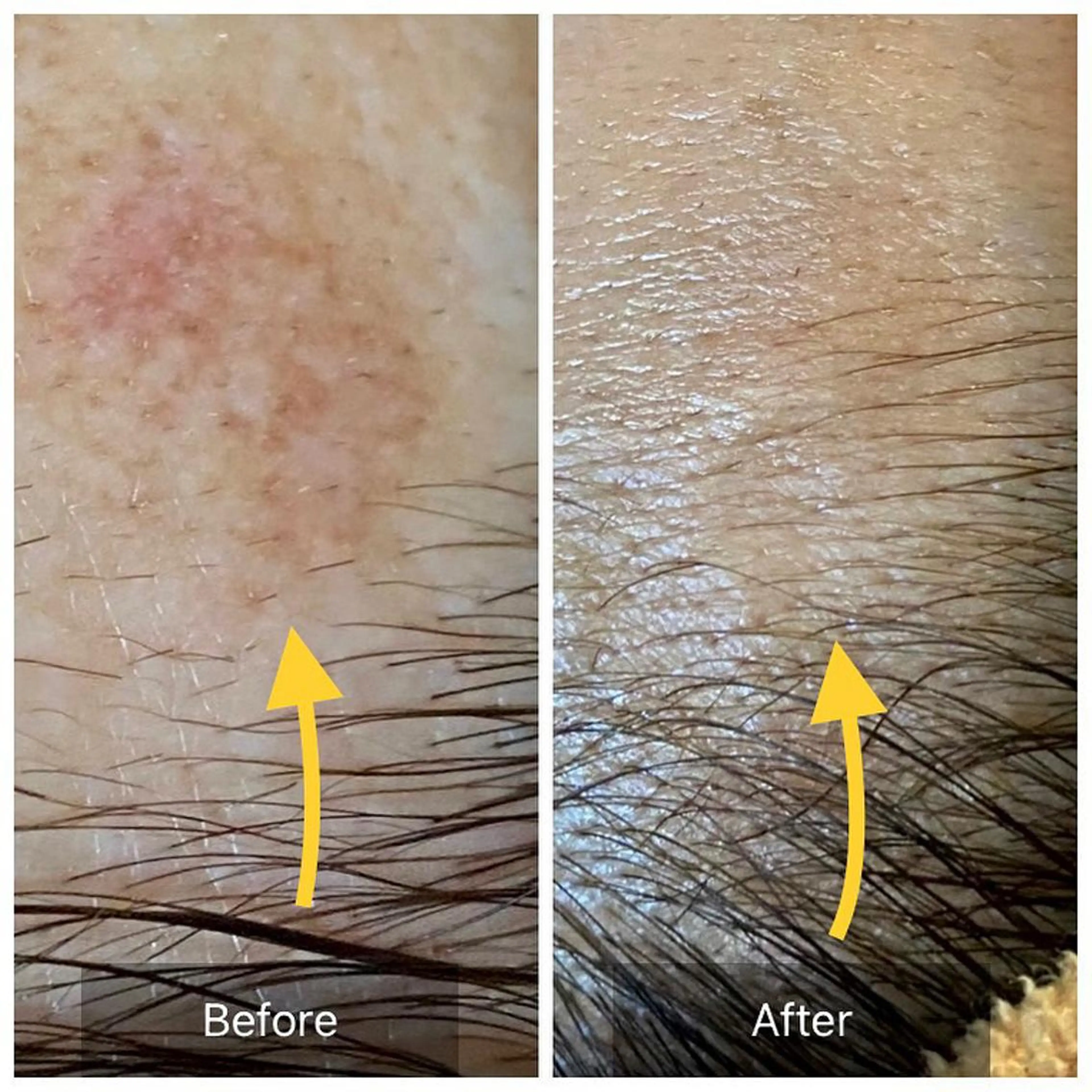 毛穴から始める肌メン テマンダリンオレンジのエステ・リラクイメージ