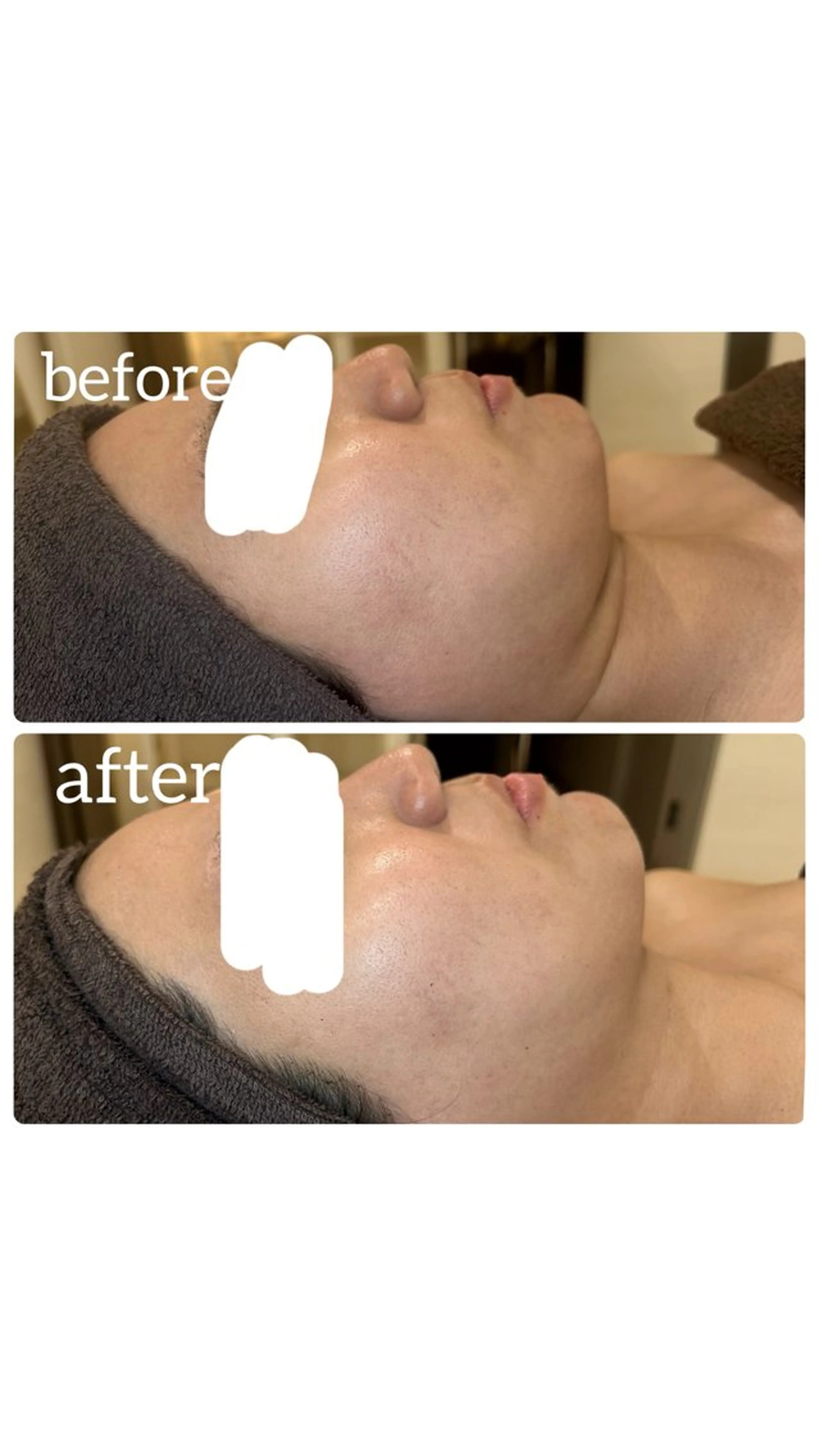 エステ BEAUTY SALON R'sのエステ・リラクイメージ