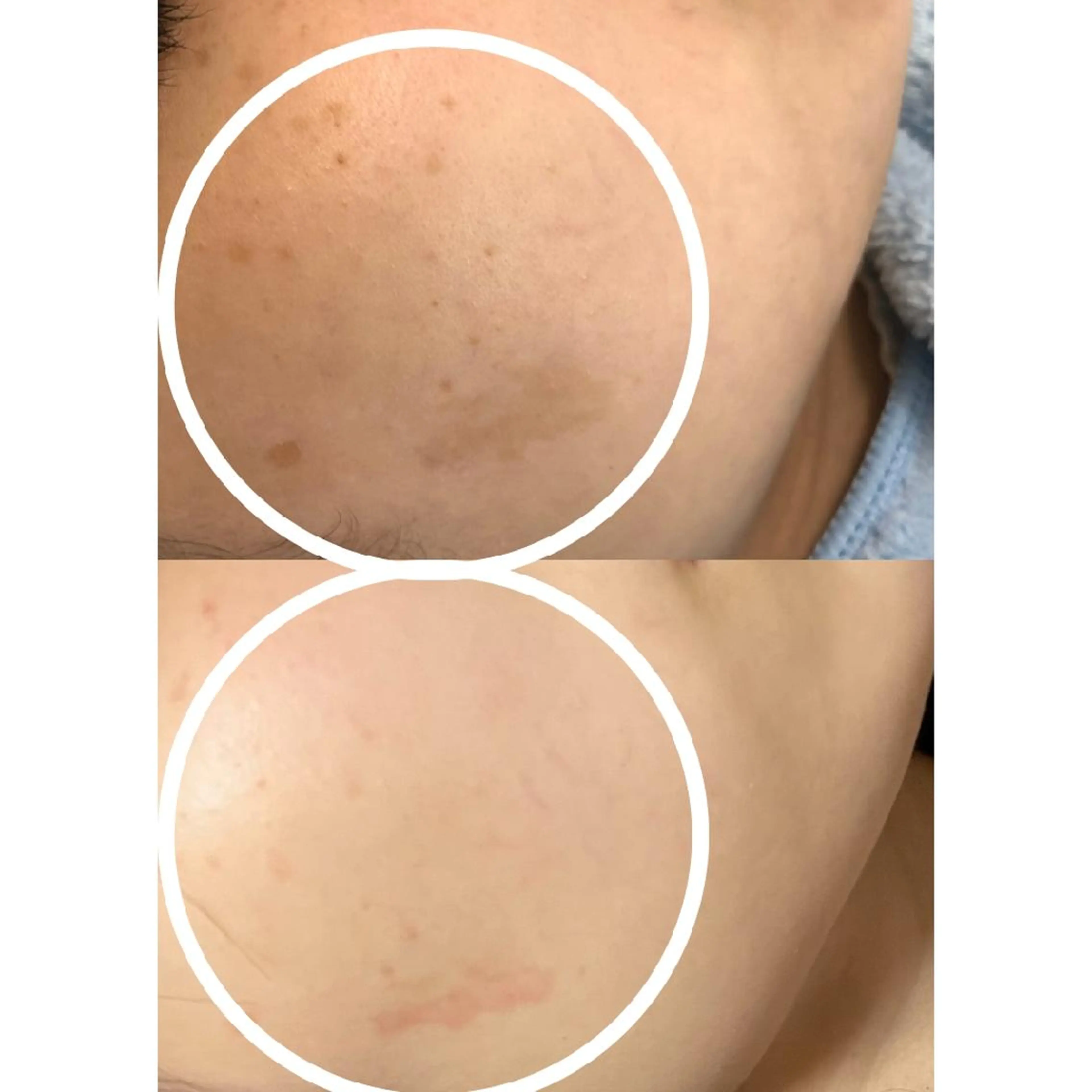 肌質改善サロン BestBelleのエステ・リラクイメージ