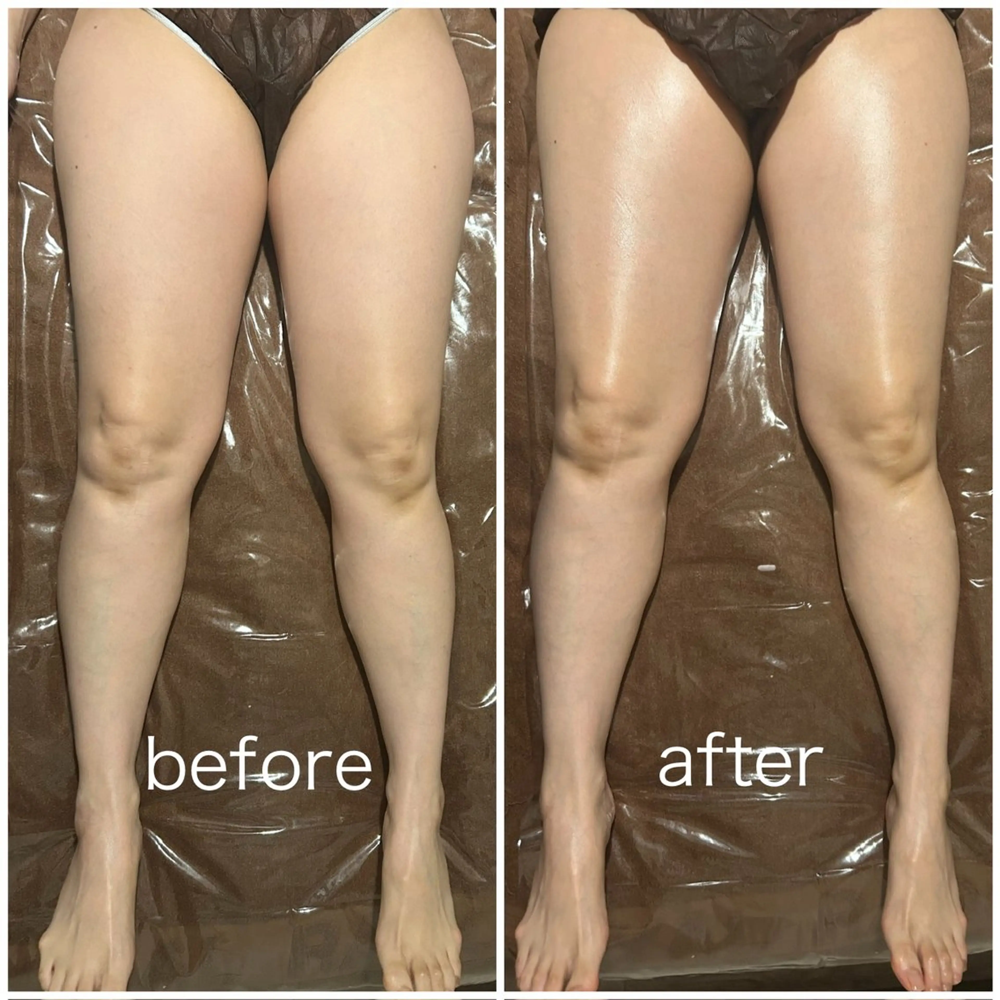 PIUMA 筋膜リリース・リンパのエステ・リラクイメージ