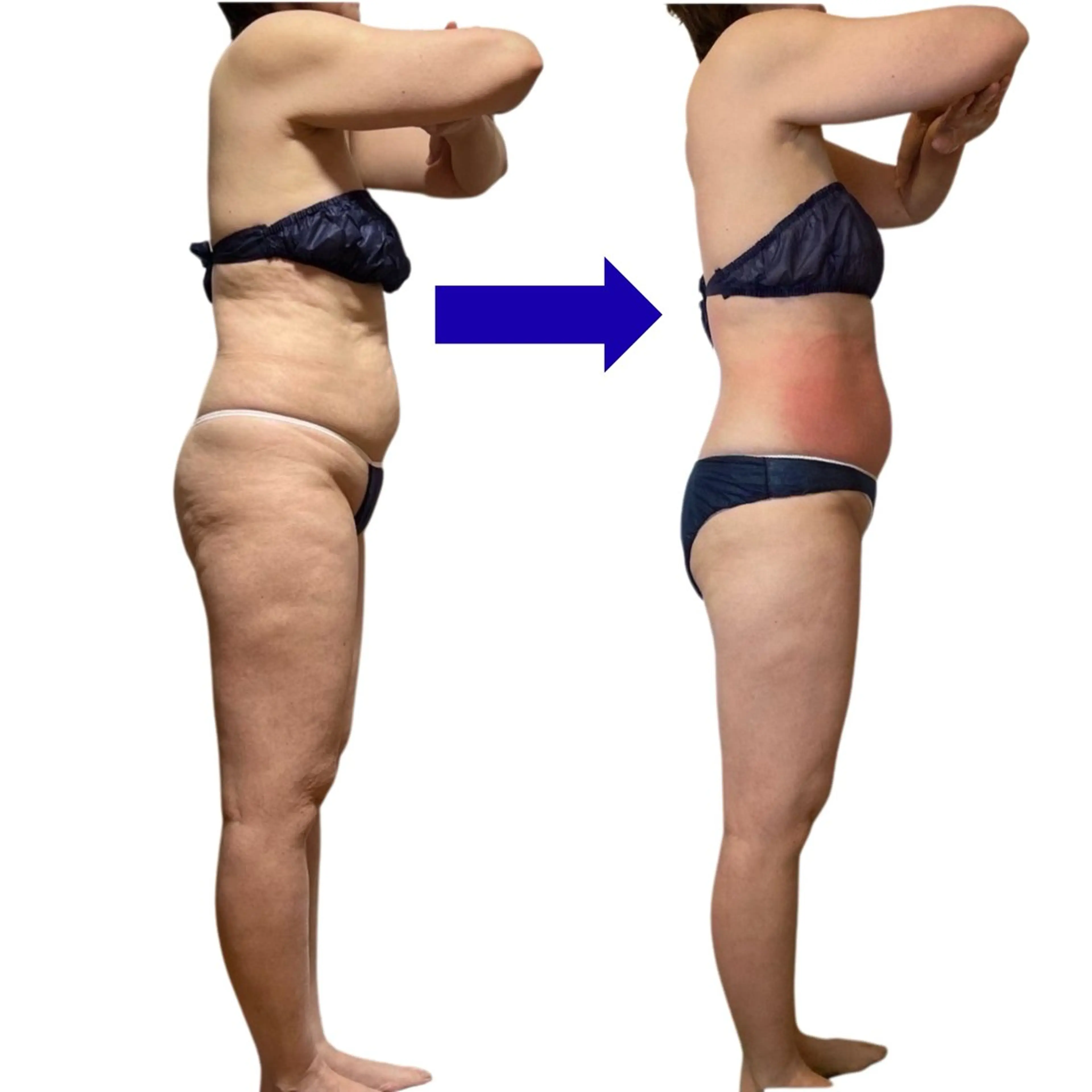 エステ 脂肪冷却/美肌改善 COCOKARAのエステ・リラクイメージ