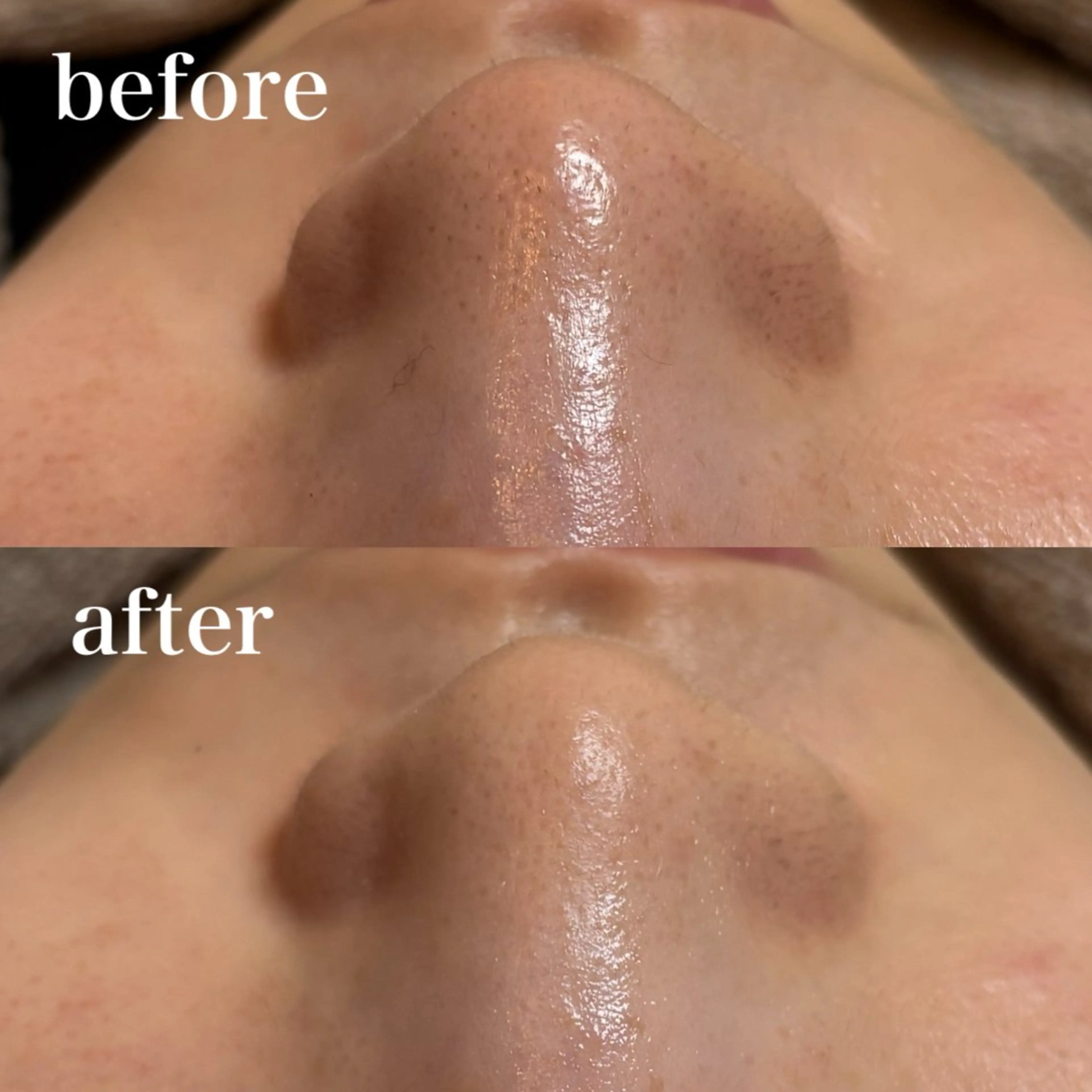 unsui spa 渋谷区神泉のエステ・リラクイメージ