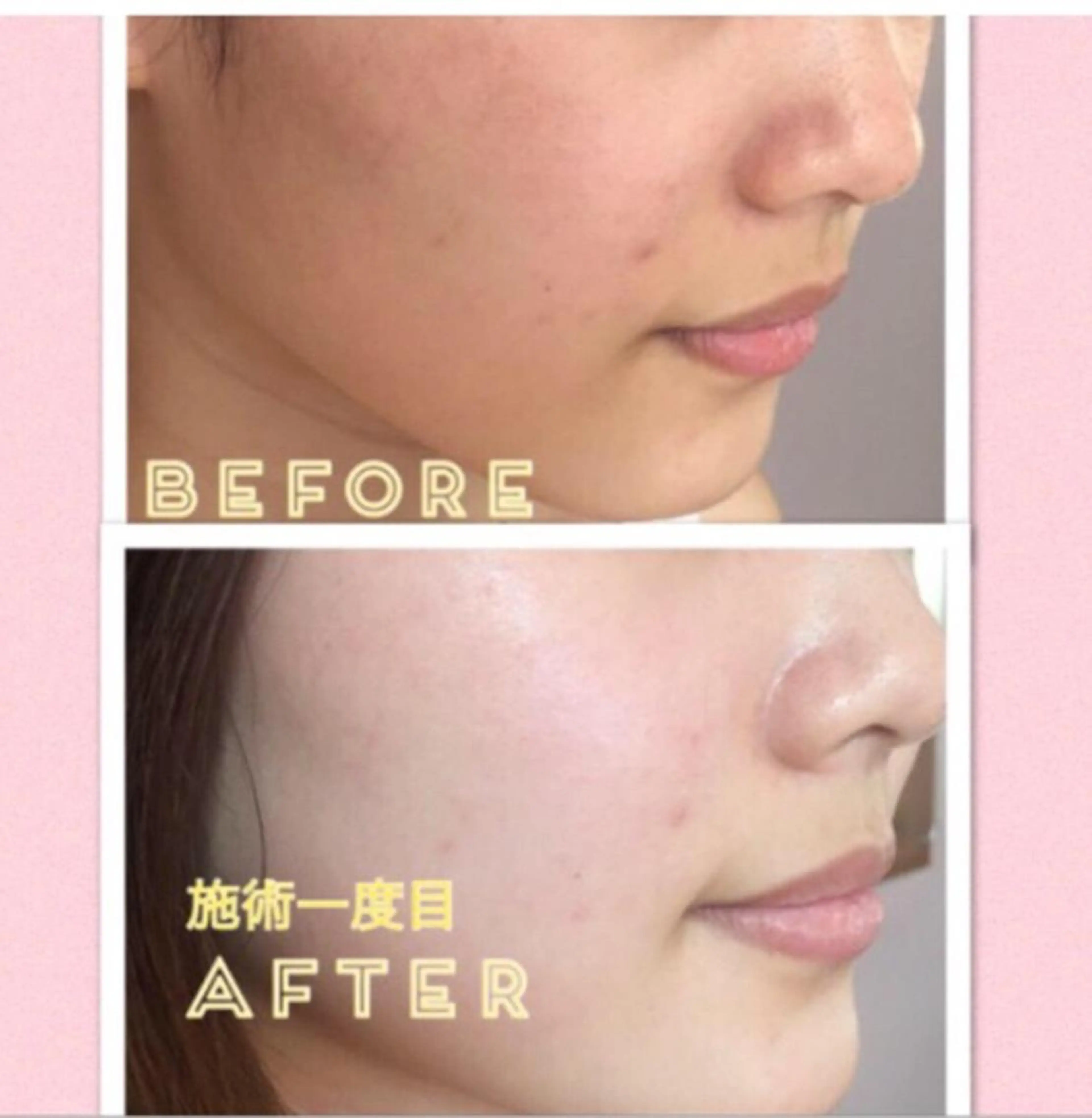 エステ リラク SMOOTH SKIN SPA.のエステ・リラクイメージ