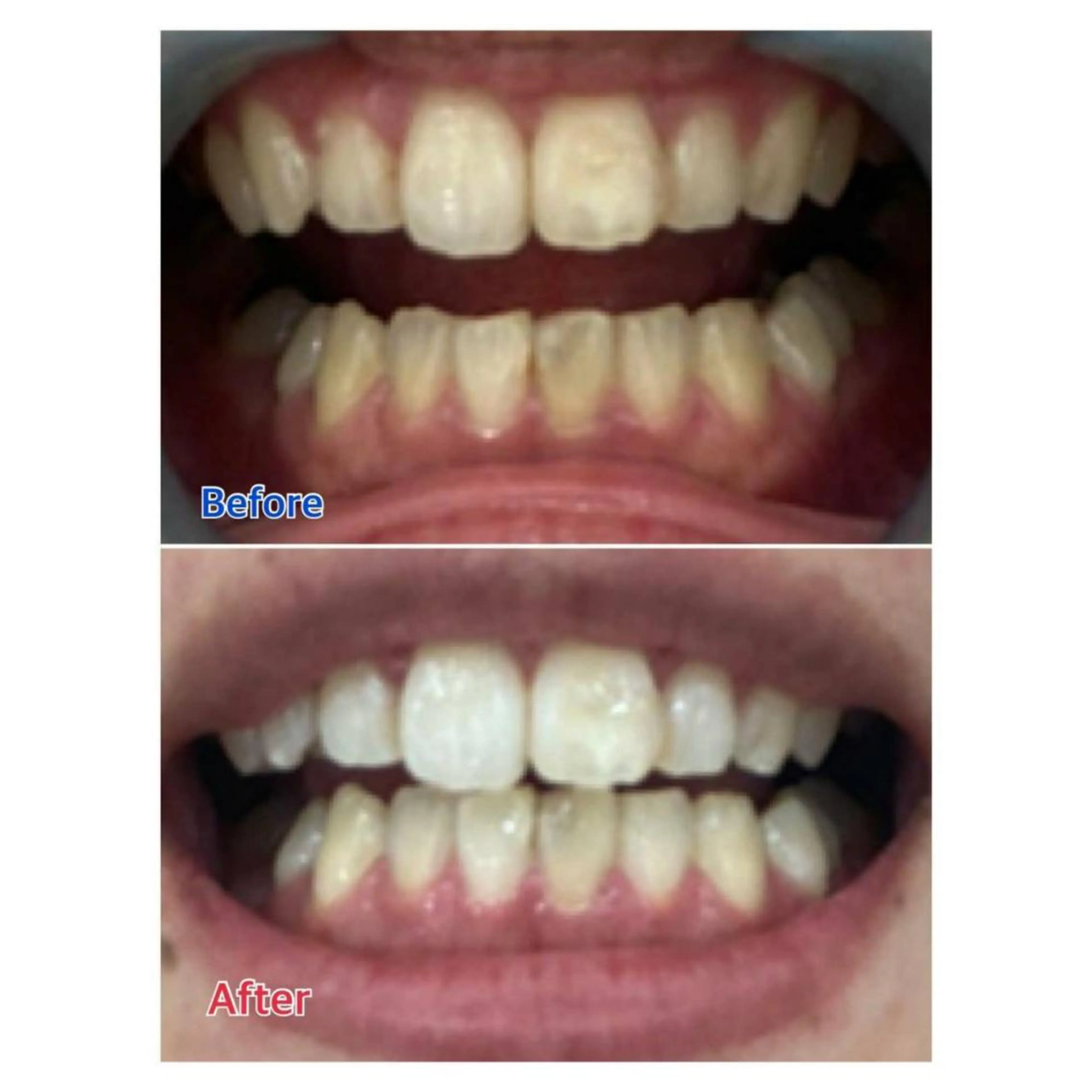 MBEAUTYSALON 千葉店・京成大久保所属・Melty 輝のその他イメージ